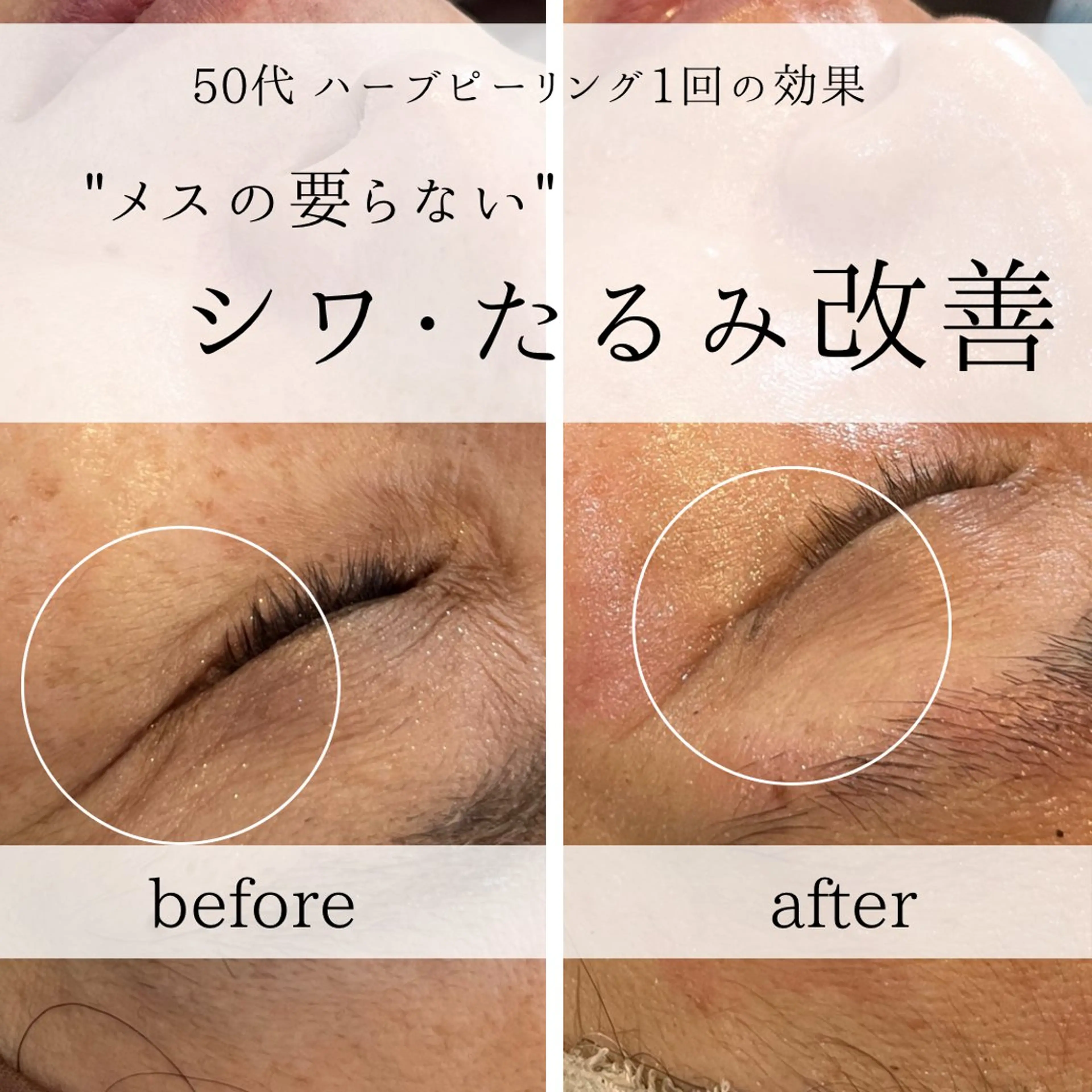 yc.hacci 【ハーブピーリング】の眉毛・アイブロウイメージ