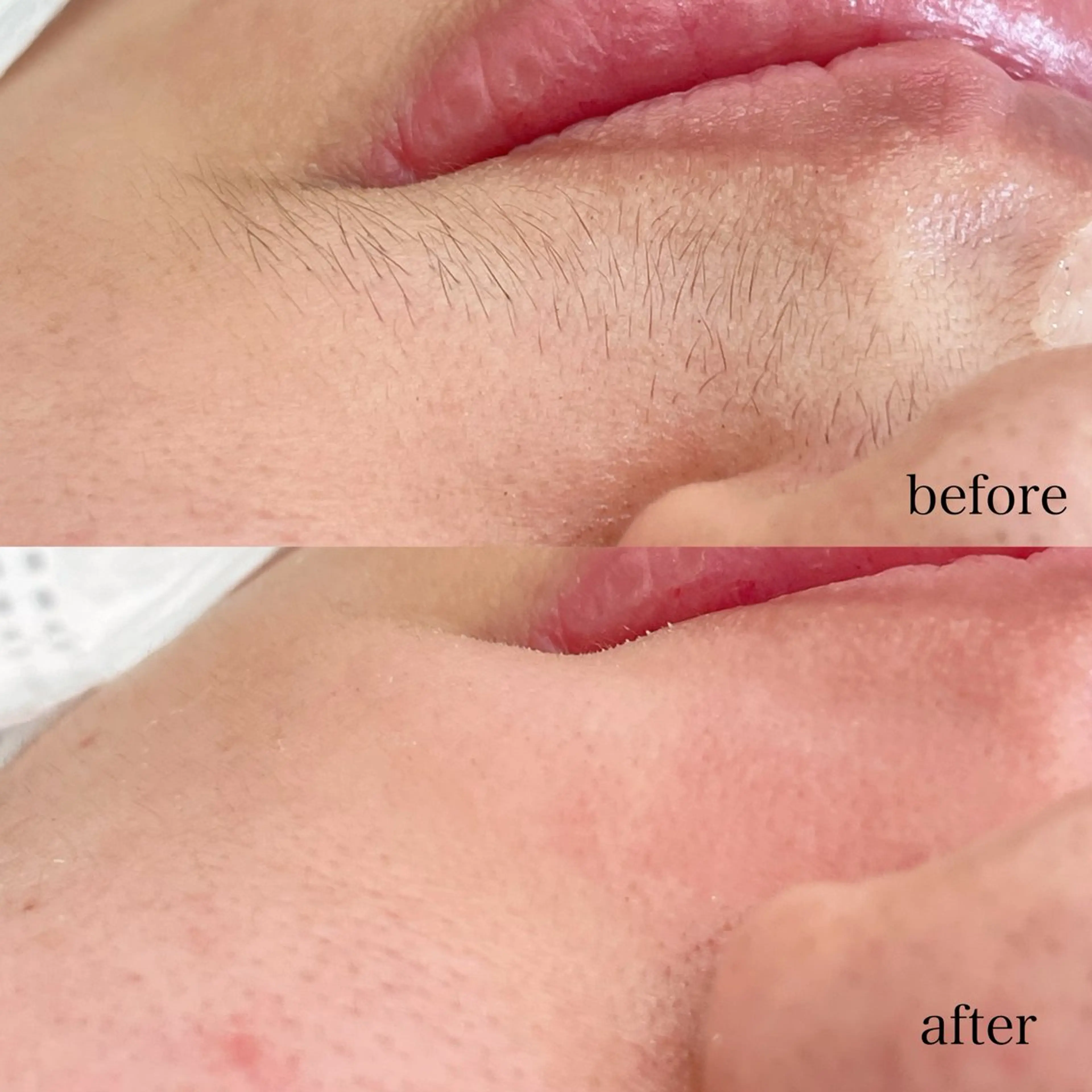 脱毛 beauty eye所属・中島 美月のマツエク・マツパデザイン