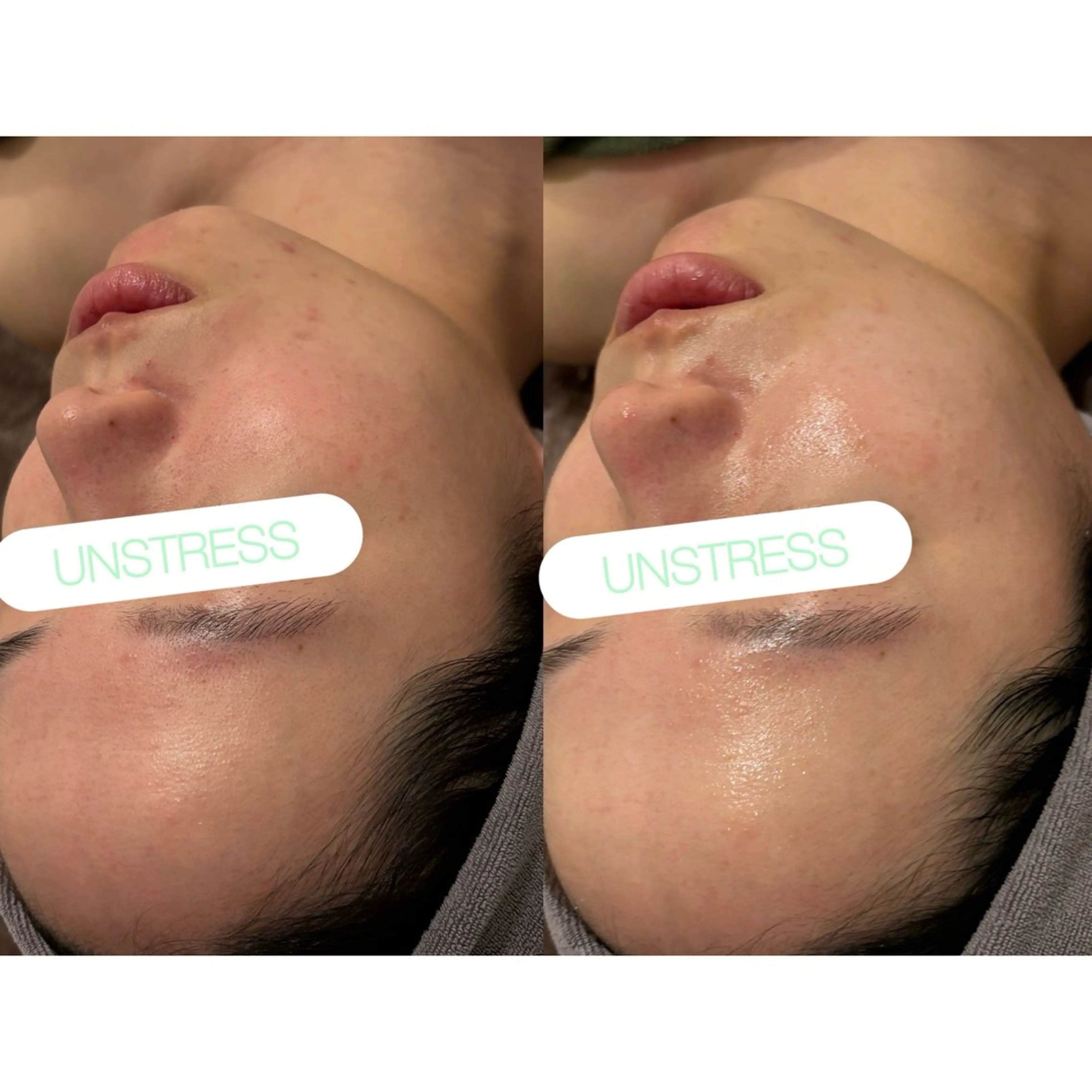 エステ 小顔コルギ ☆表参道/外苑前のエステ・リラクイメージ