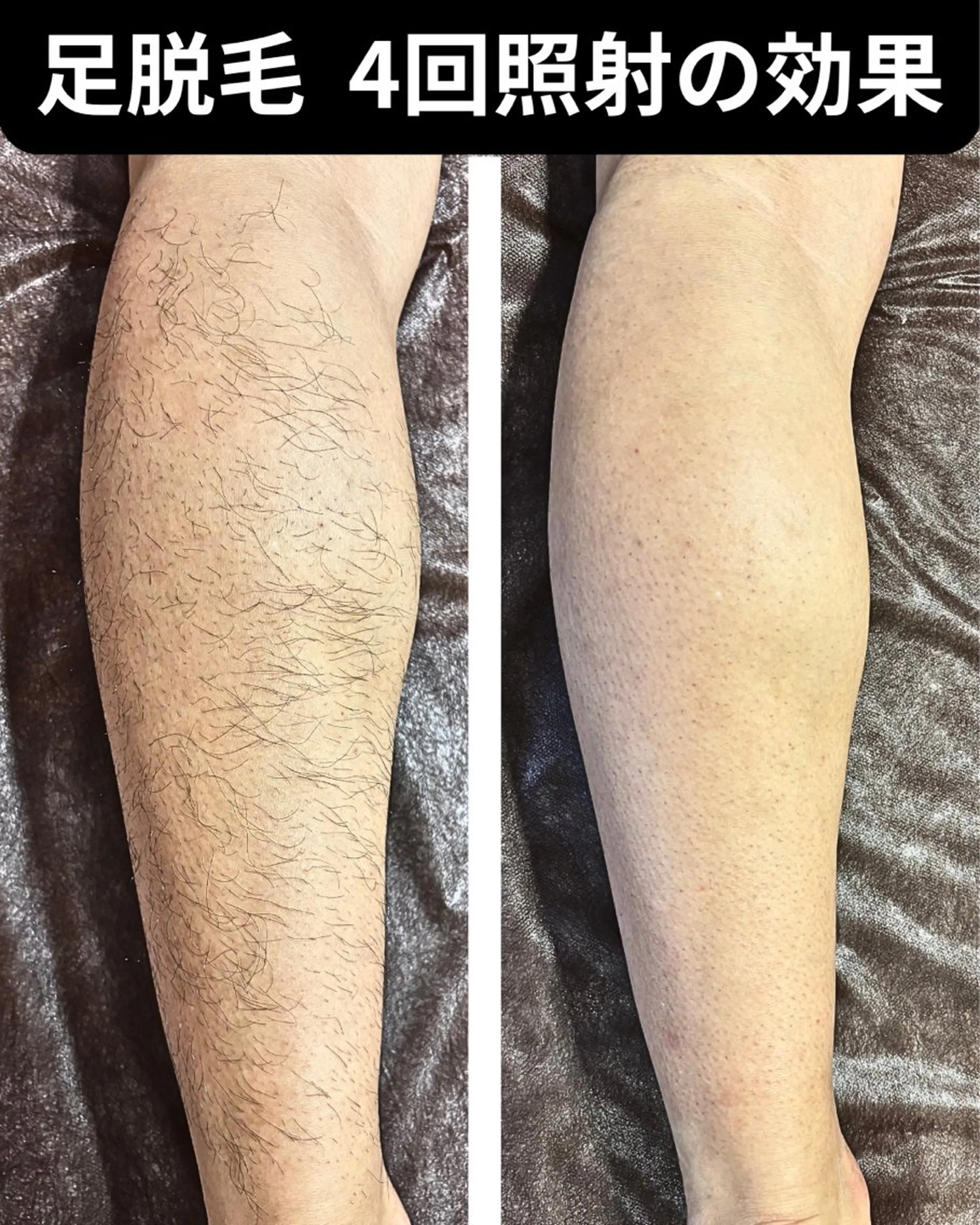 脱毛サロン FIS武蔵小杉店のエステ・リラクイメージ