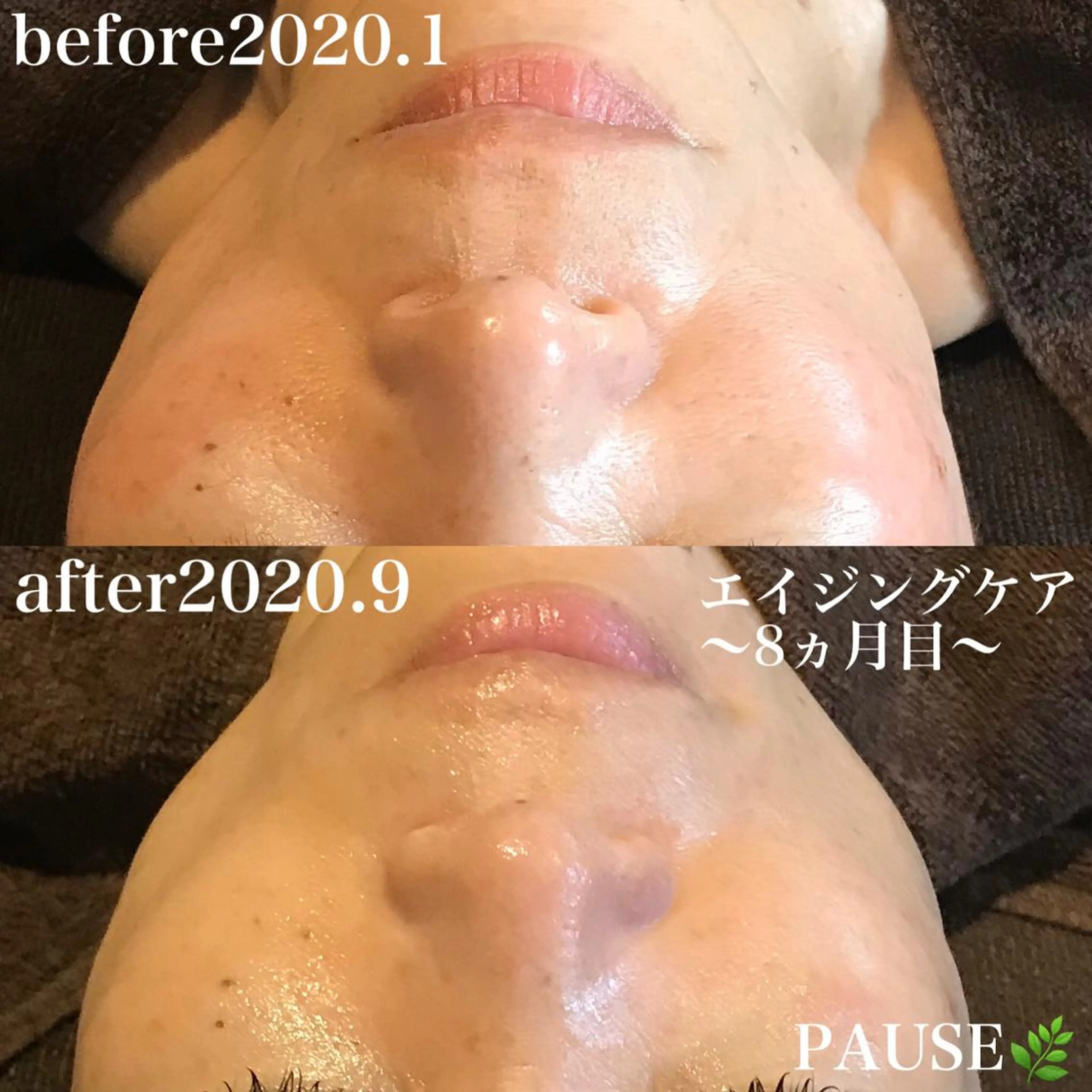 エステ 浜野 恵美のエステ・リラクイメージ