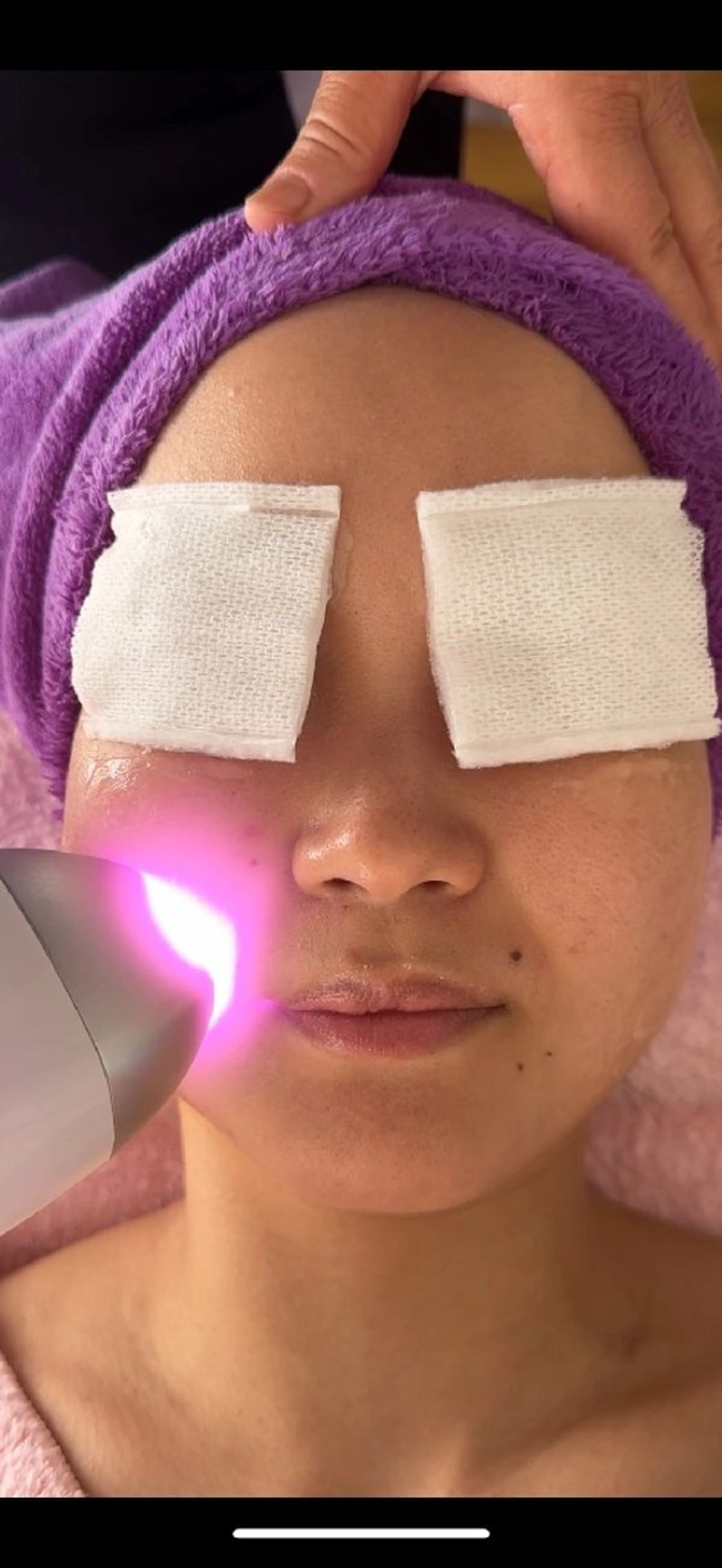 韓流光フェイシャル 桁違いの透明な肌に!の写真