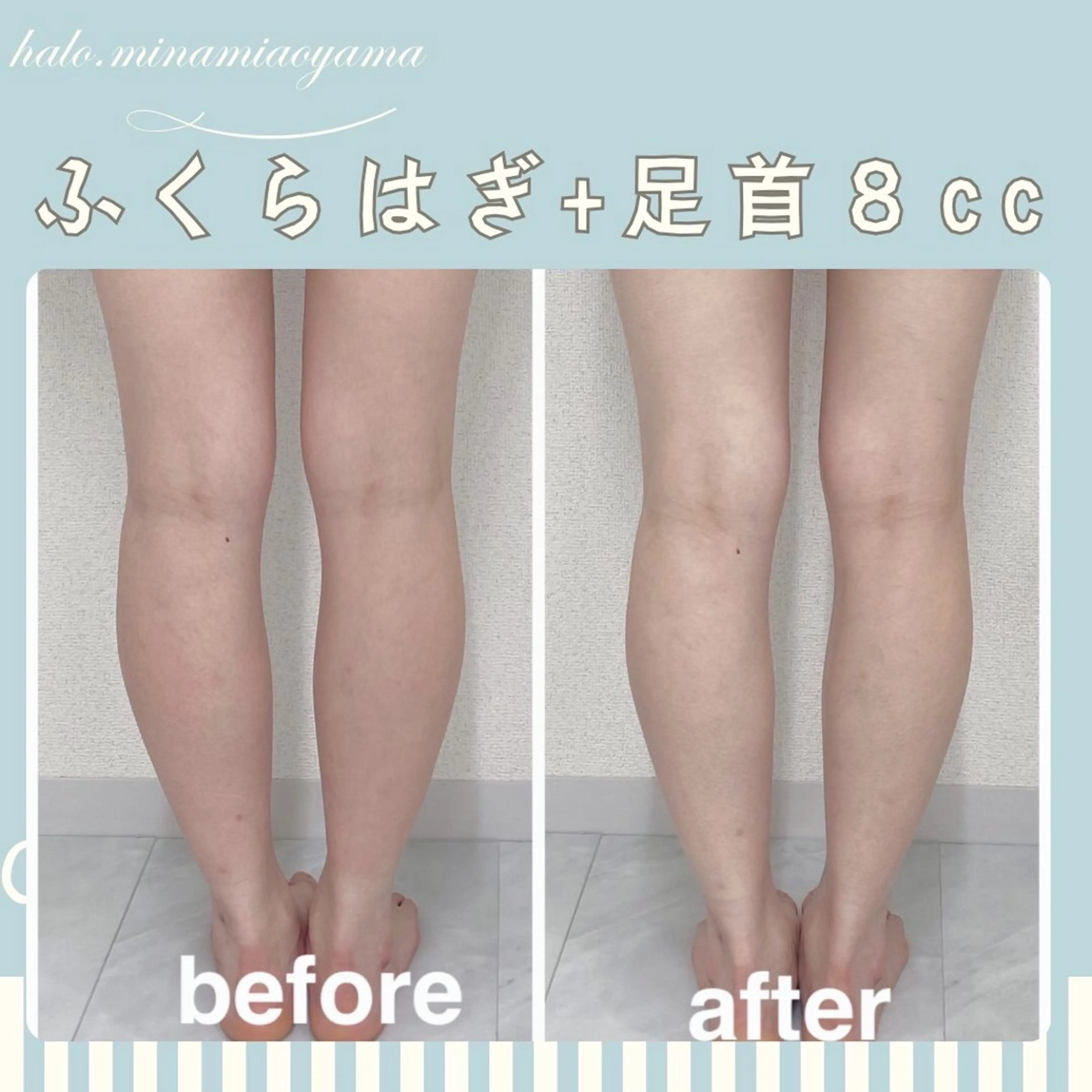 小顔痩身HALO 二宮早織のエステ・リラクイメージ