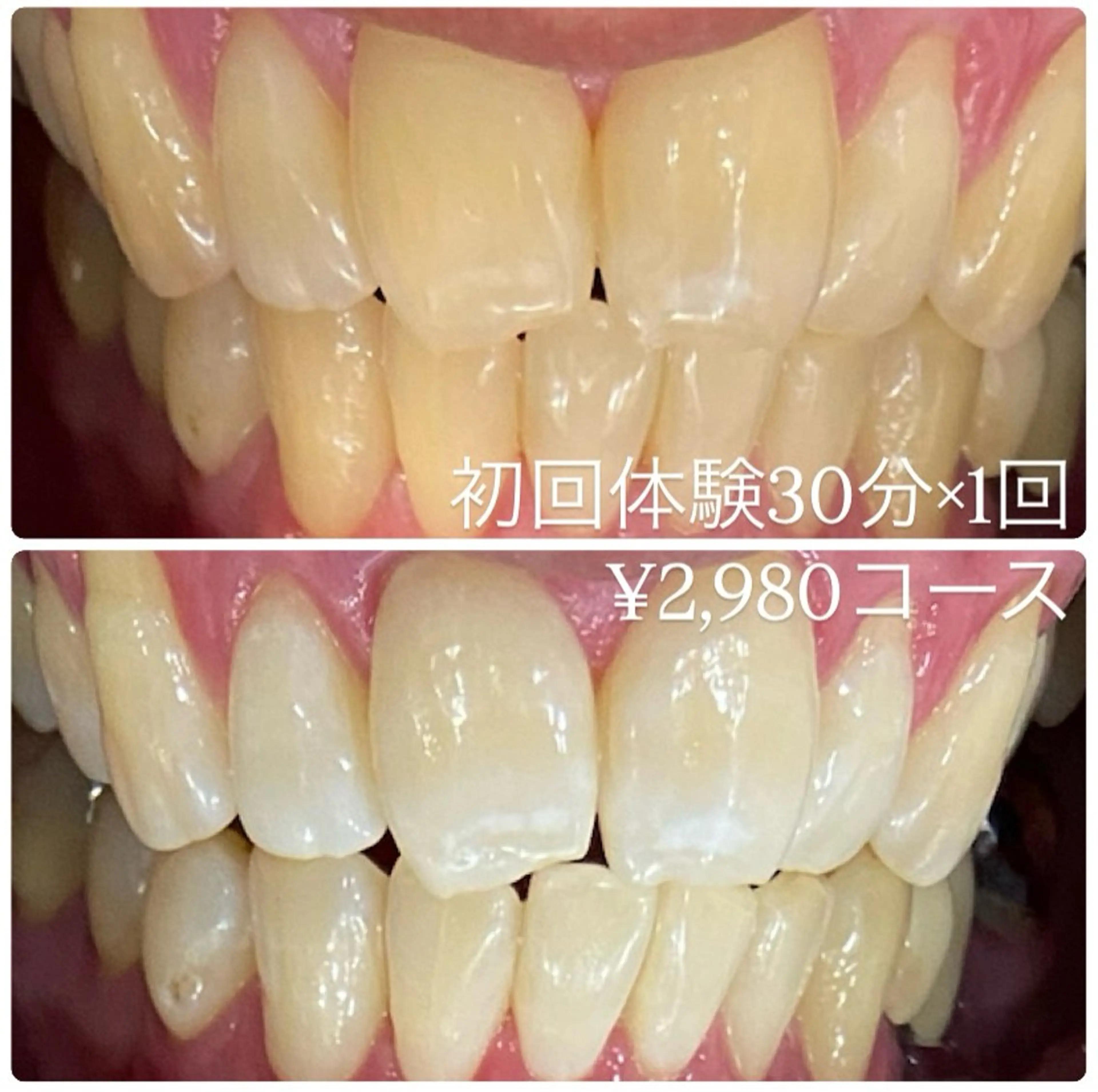 ホワイトニングルーム 横浜店のその他イメージ