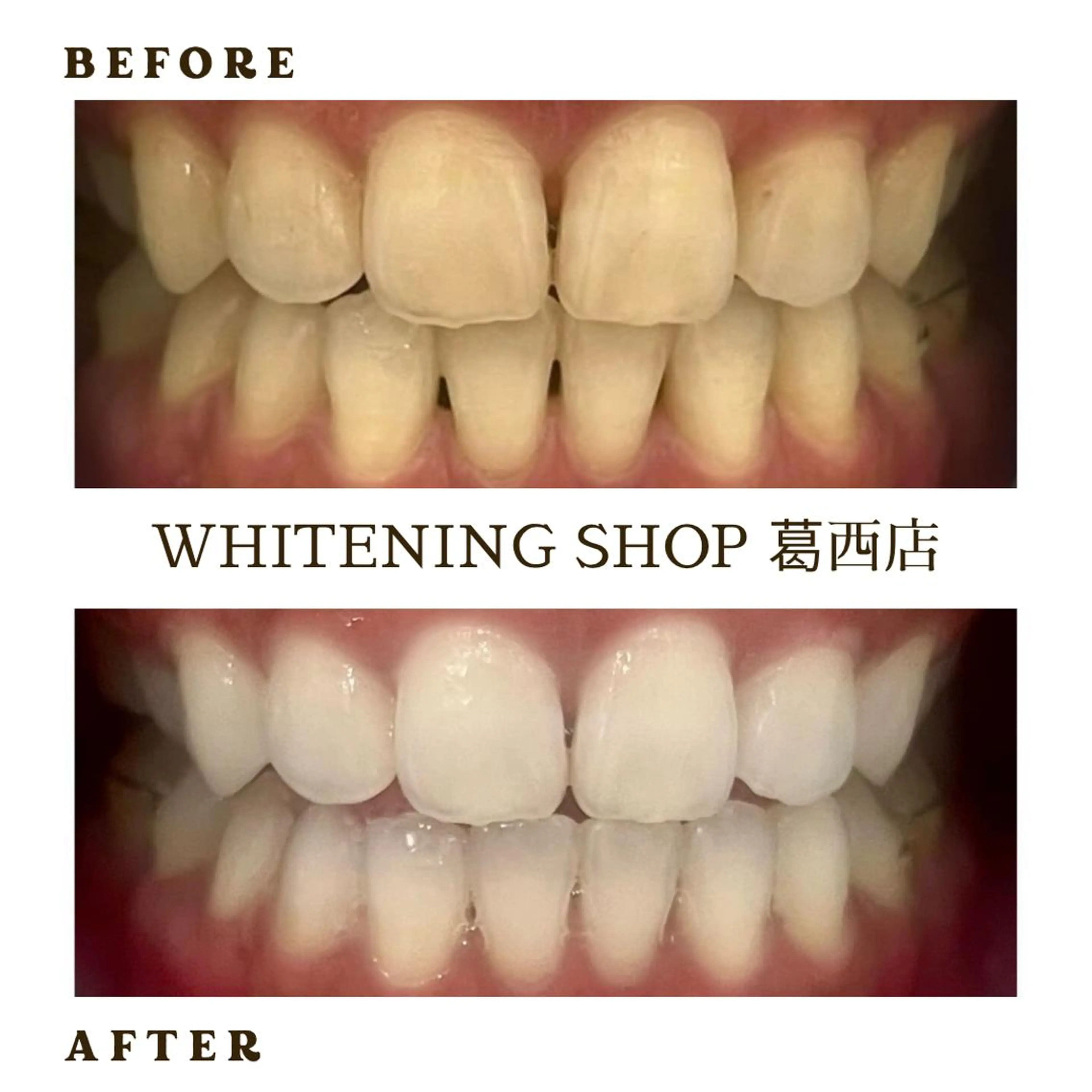 メンズ その他 ホワイトニング ショップ葛西店のその他イメージ