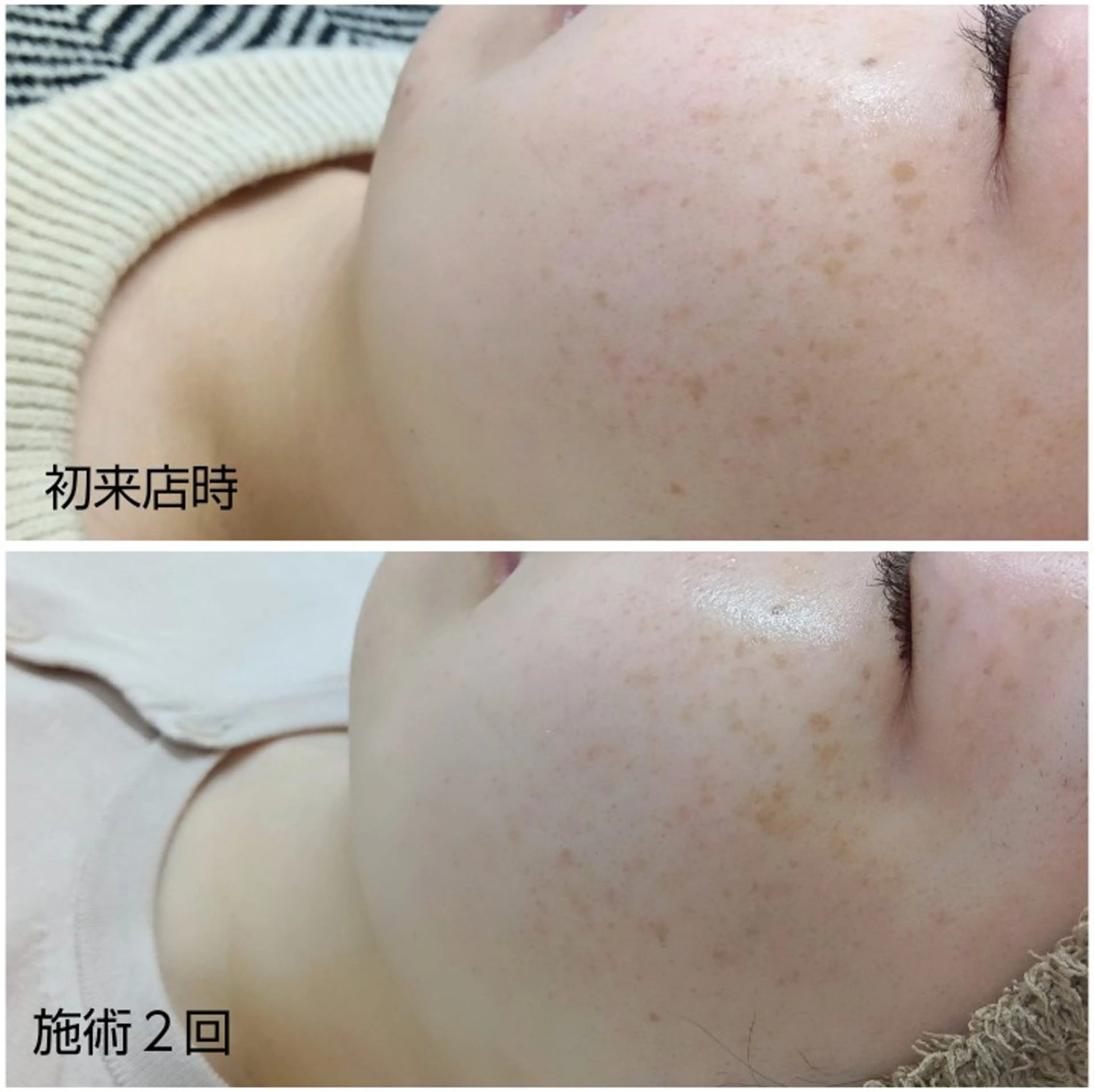 シミケア専門店 HAQUAのエステ・リラクイメージ