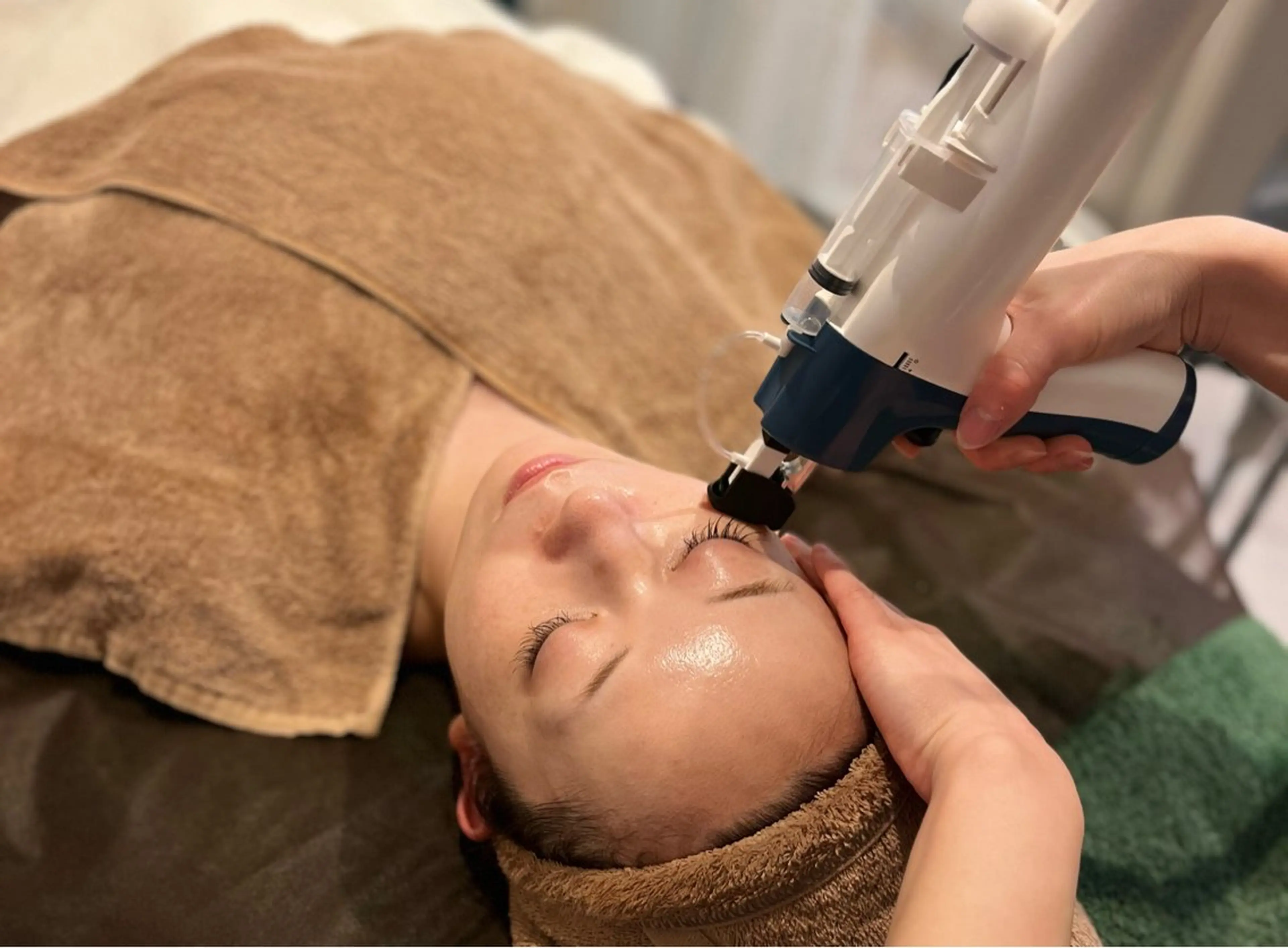 【肌再生】ヒト幹細胞導入でマイナス10歳肌の写真