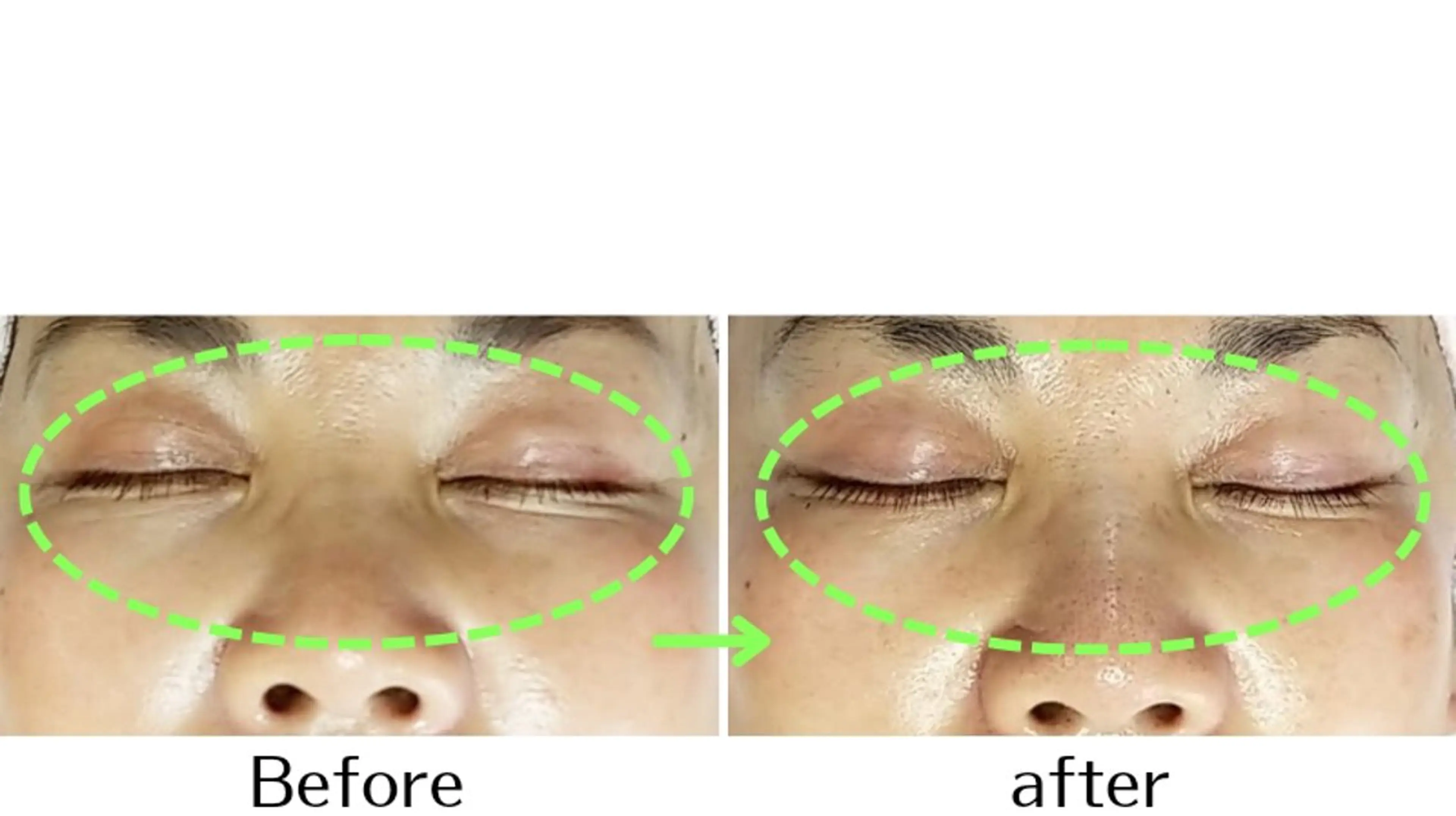 自然派フェイシャル やながわのエステ・リラクイメージ