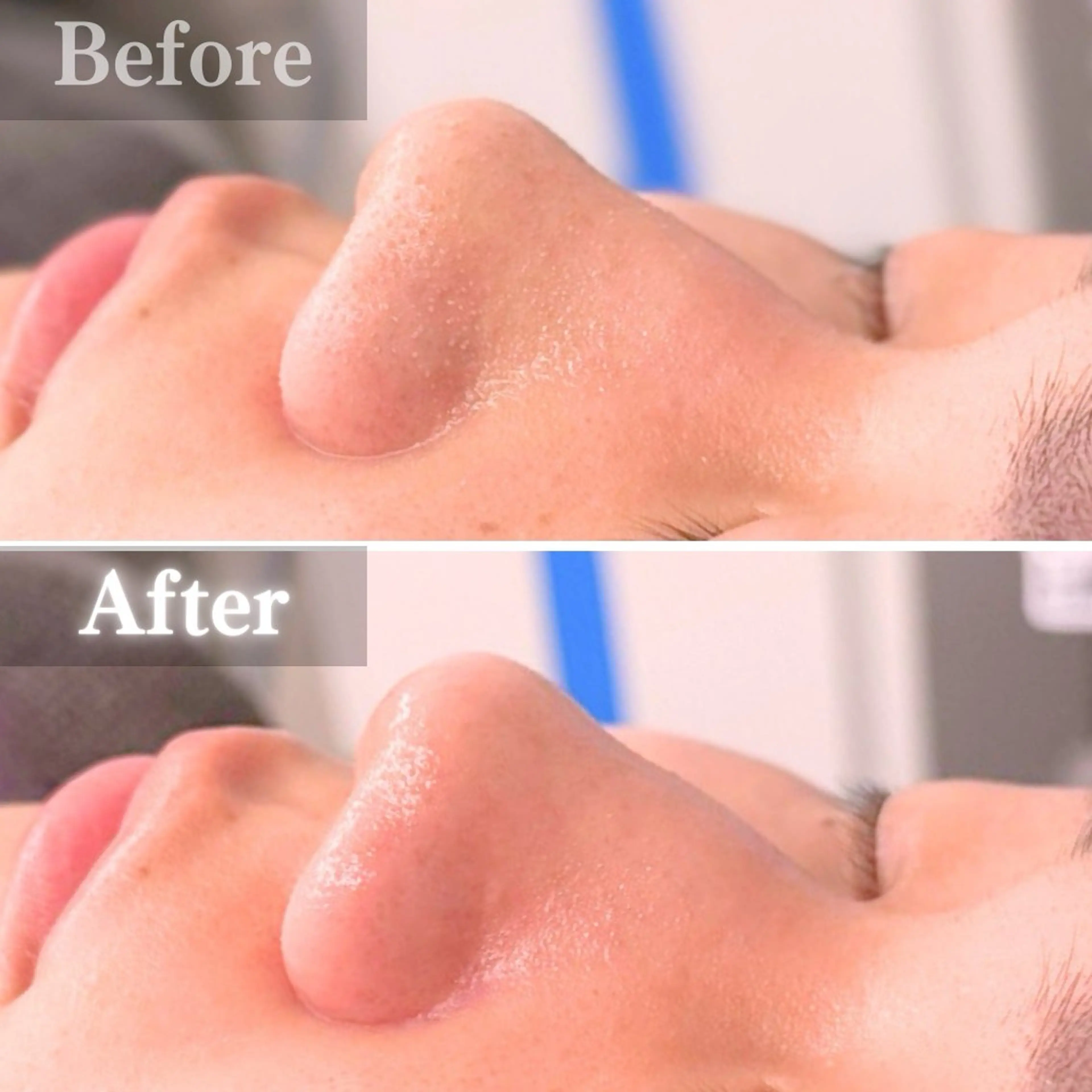 エステ 毛穴洗浄特化🫧 オオツカのエステ・リラクイメージ