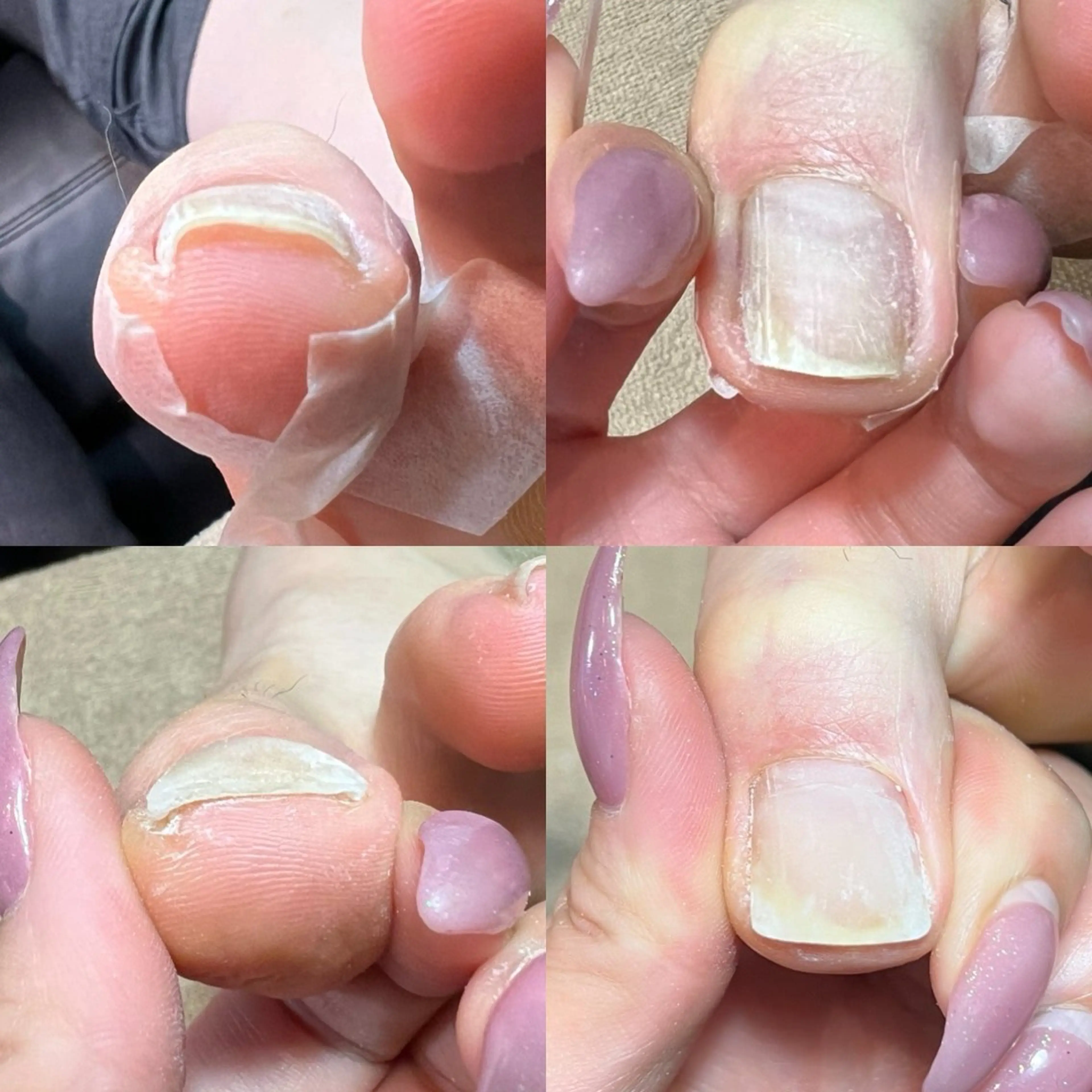 ネイル フットネイル Cure.美爪育成 salon 岡澤のネイルデザイン