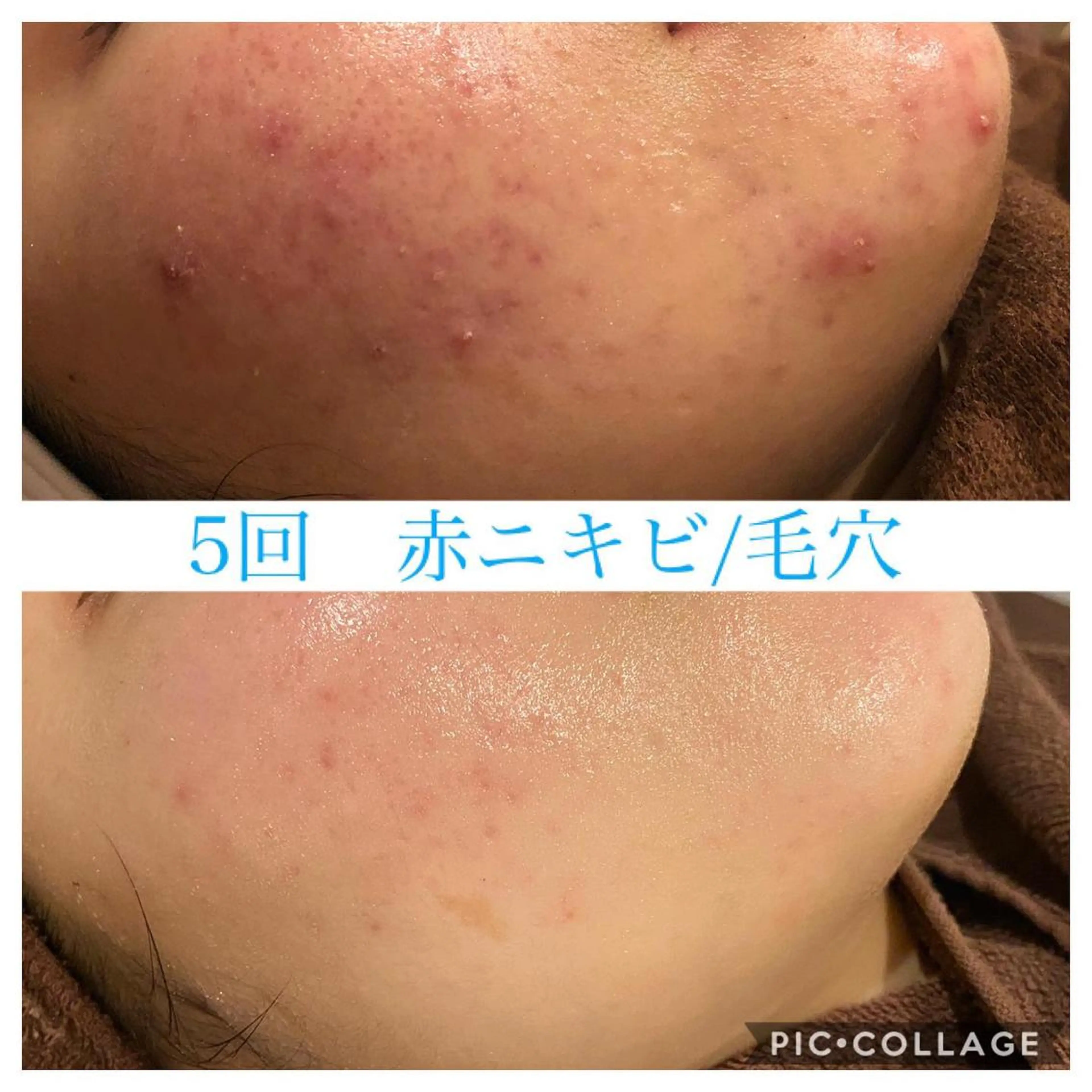 ショート カラー パーマ ヘアアレンジ メンズ ネイル マツエク・マツパ エステ リラク Ensor Clair所属・EnsorClair 代表 野口真央のエステ・リラクイメージ