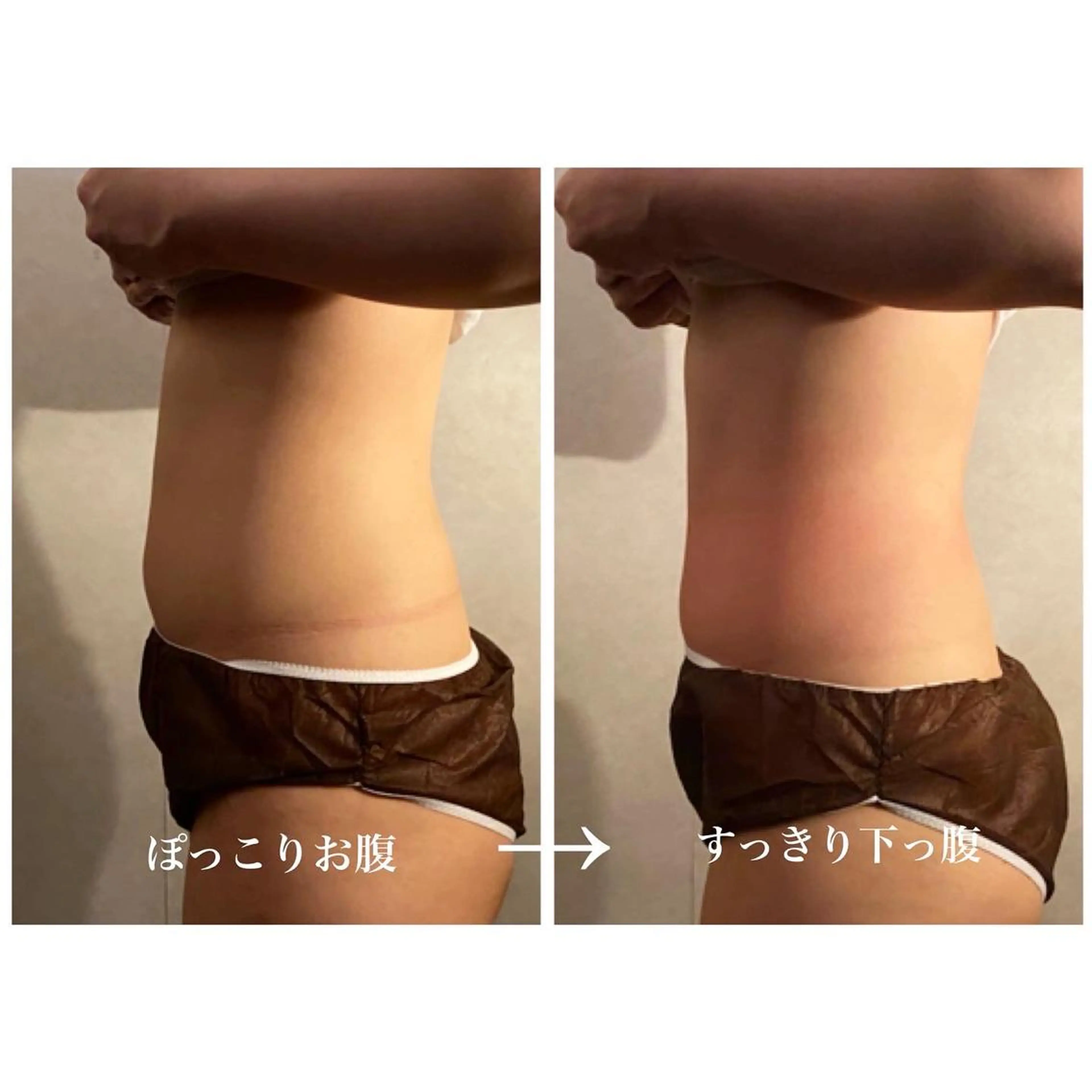 美容鍼灸サロン YOSHINOのエステ・リラクイメージ