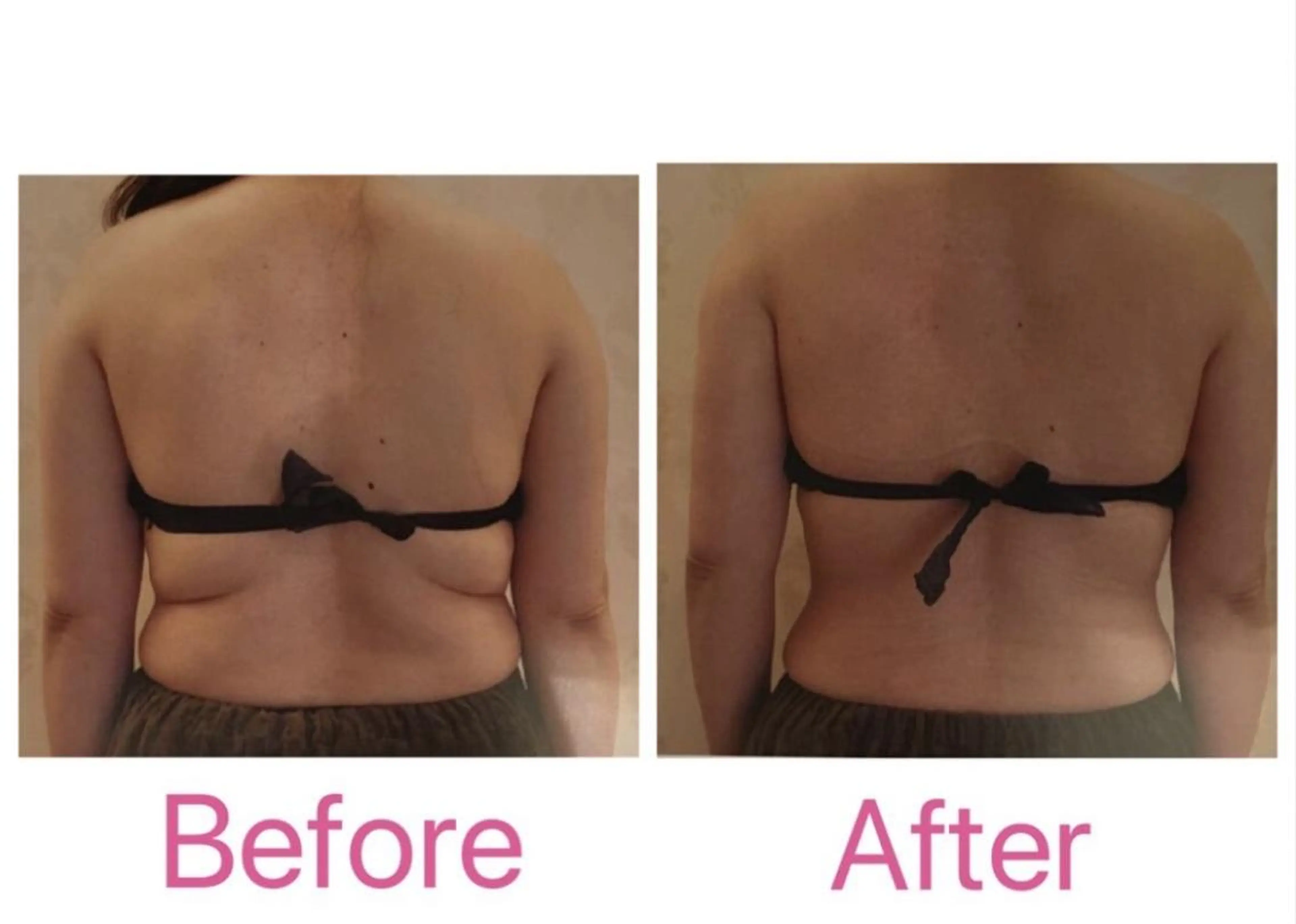 エステ BELINDA銀座店 ✨痩身エステサロン✨のエステ・リラクイメージ