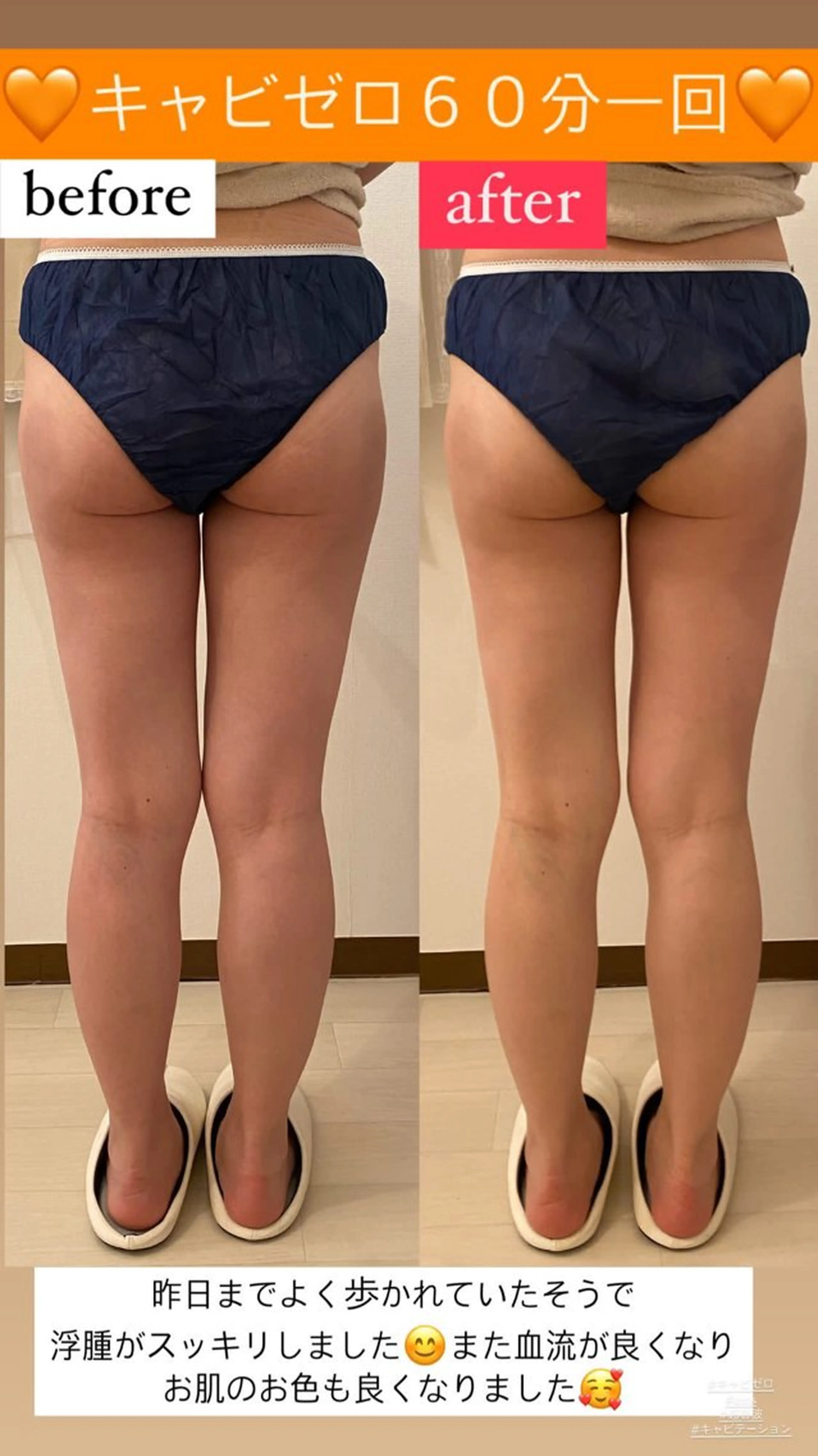 エステ リラク Salon de Lino 御器所のエステ・リラクイメージ