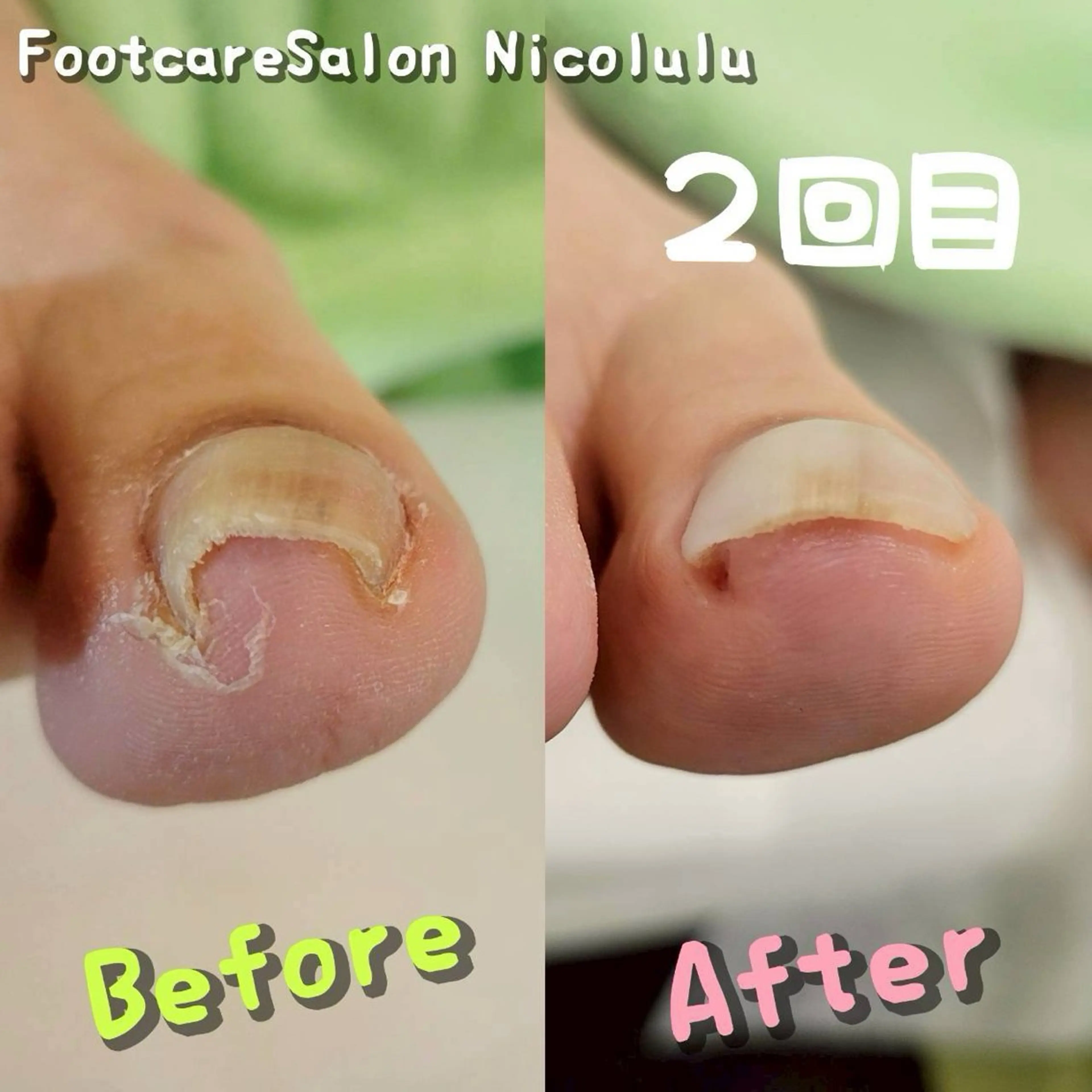 リラク 足トラブル専門 ニコルル金沢のエステ・リラクイメージ