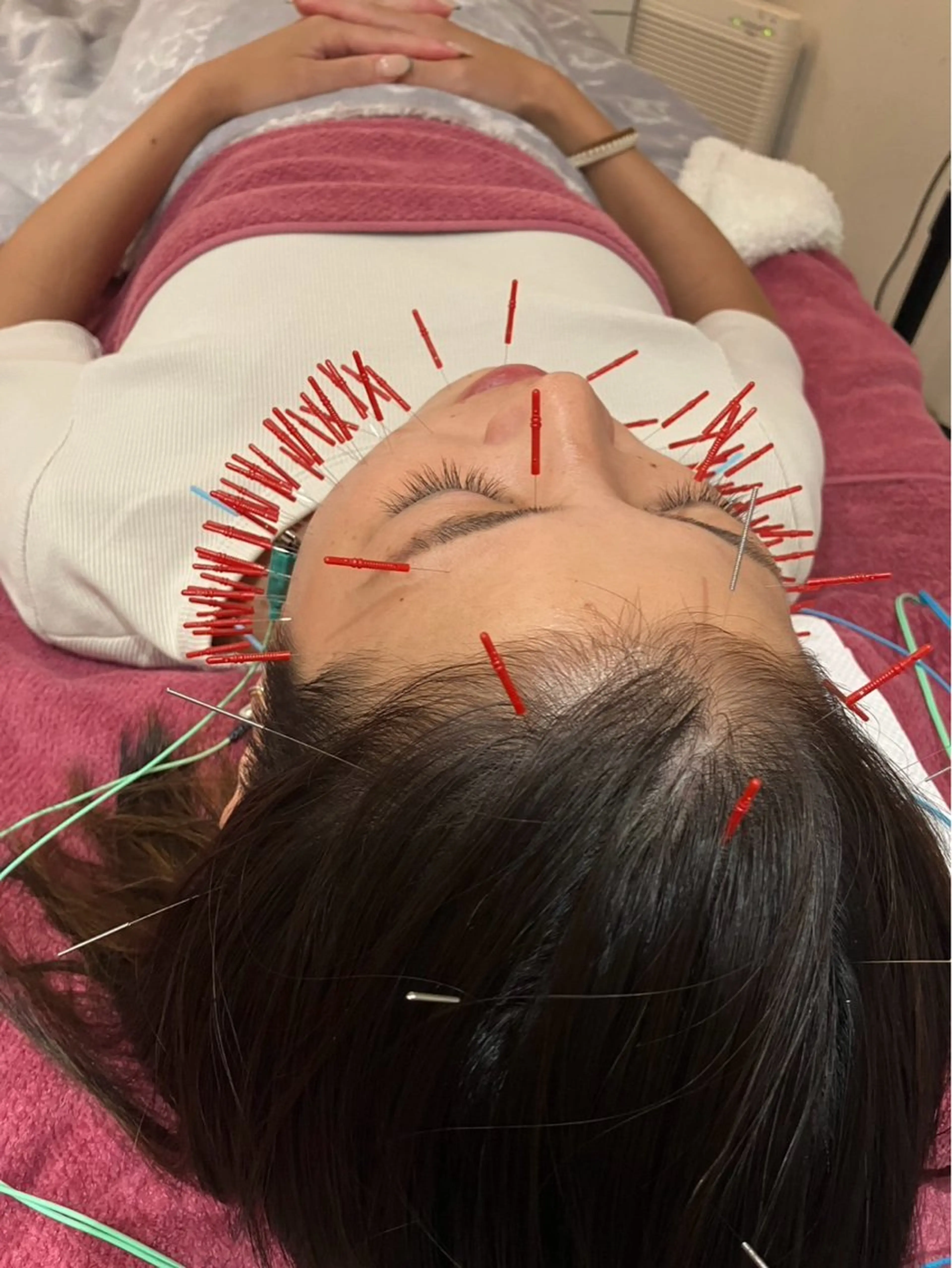 エステ リラク 美容鍼灸女性専用 りんご鍼灸治療院のその他イメージ