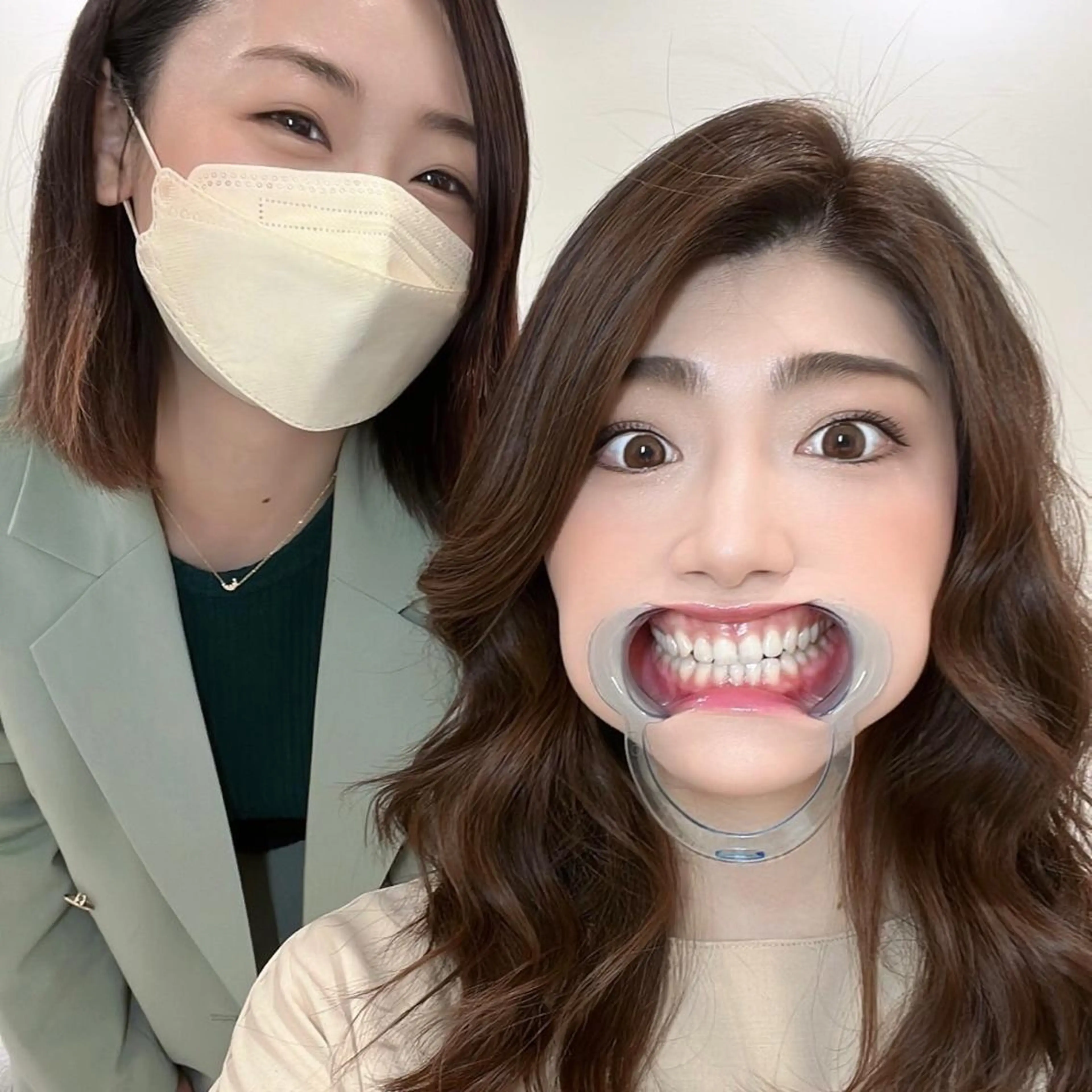 セルフホワイトニング 🦷口元垢抜け✨のその他イメージ