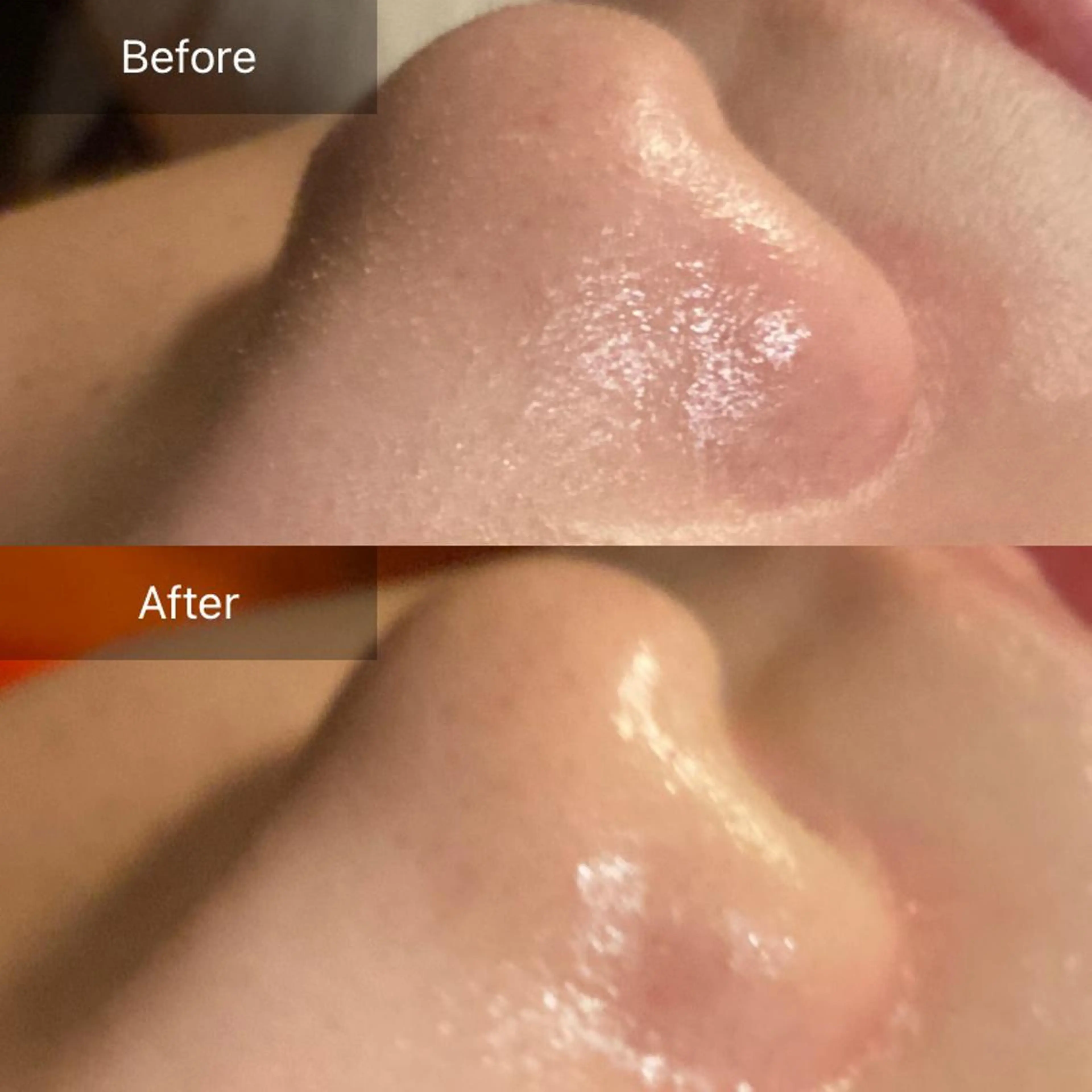 Mandarin Orange所属・毛穴から始める肌メン テマンダリンオレンジのエステ・リラクイメージ