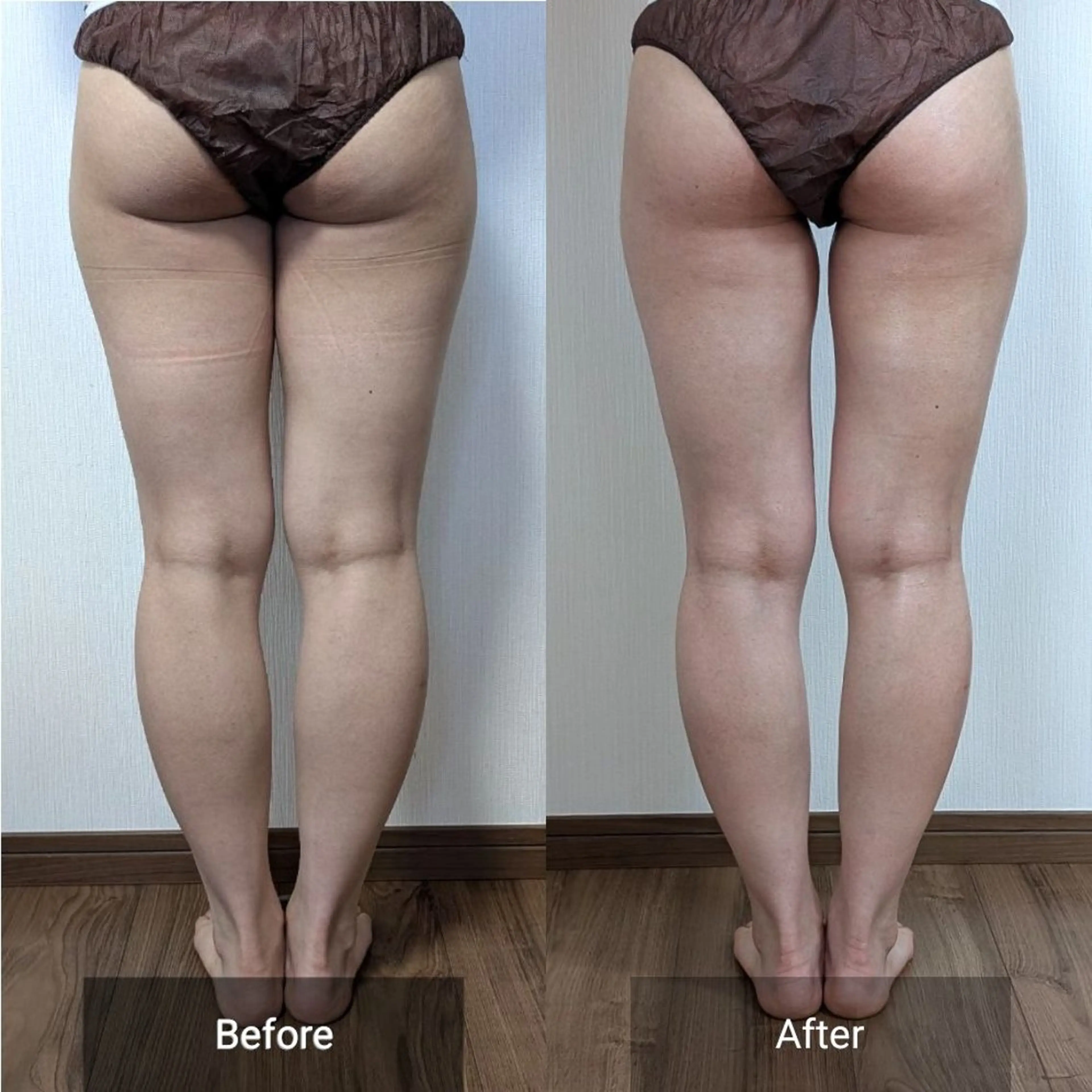 エステ nail RiRi アトレナチュラのエステ・リラクイメージ