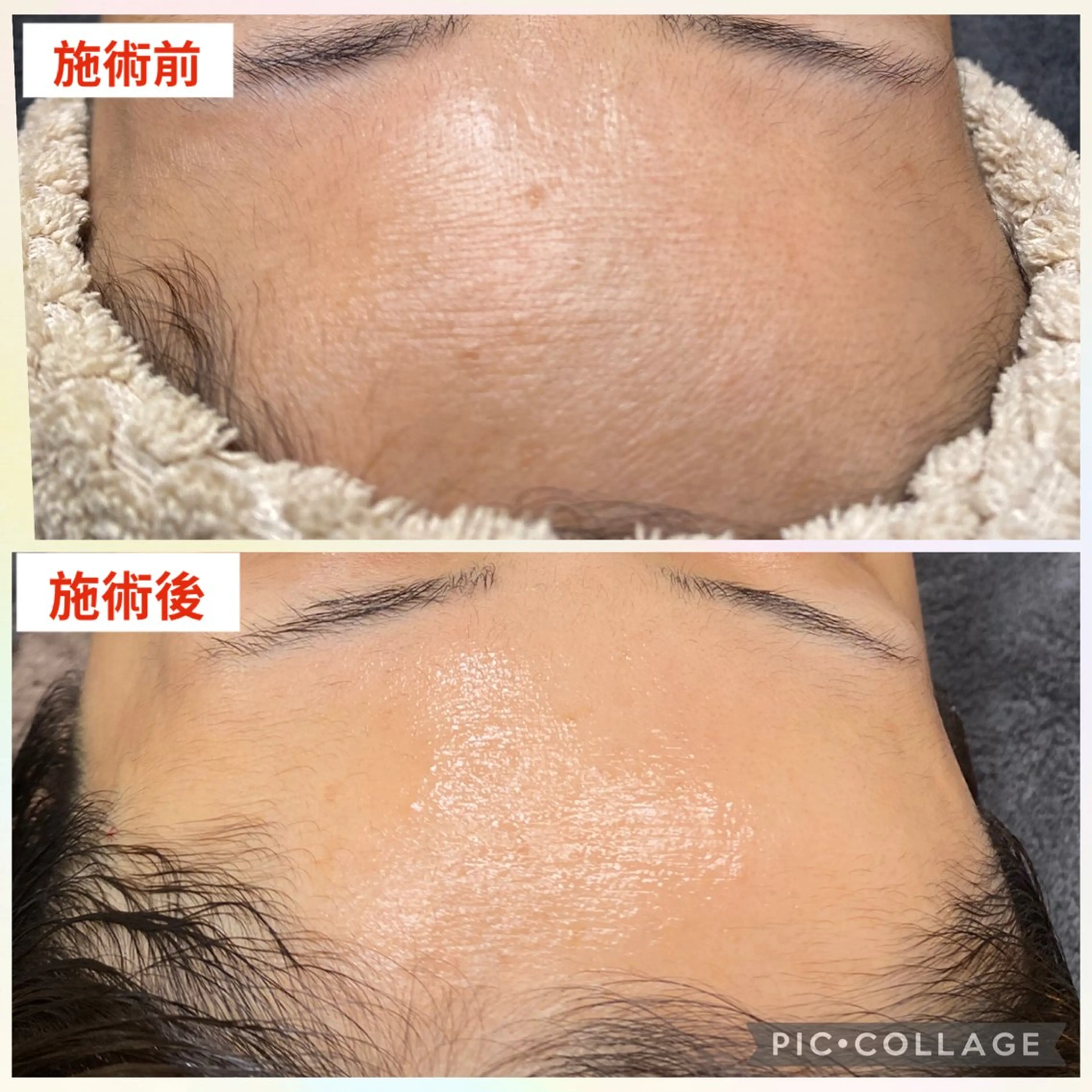 肌質改善サロン with Uのエステ・リラクイメージ