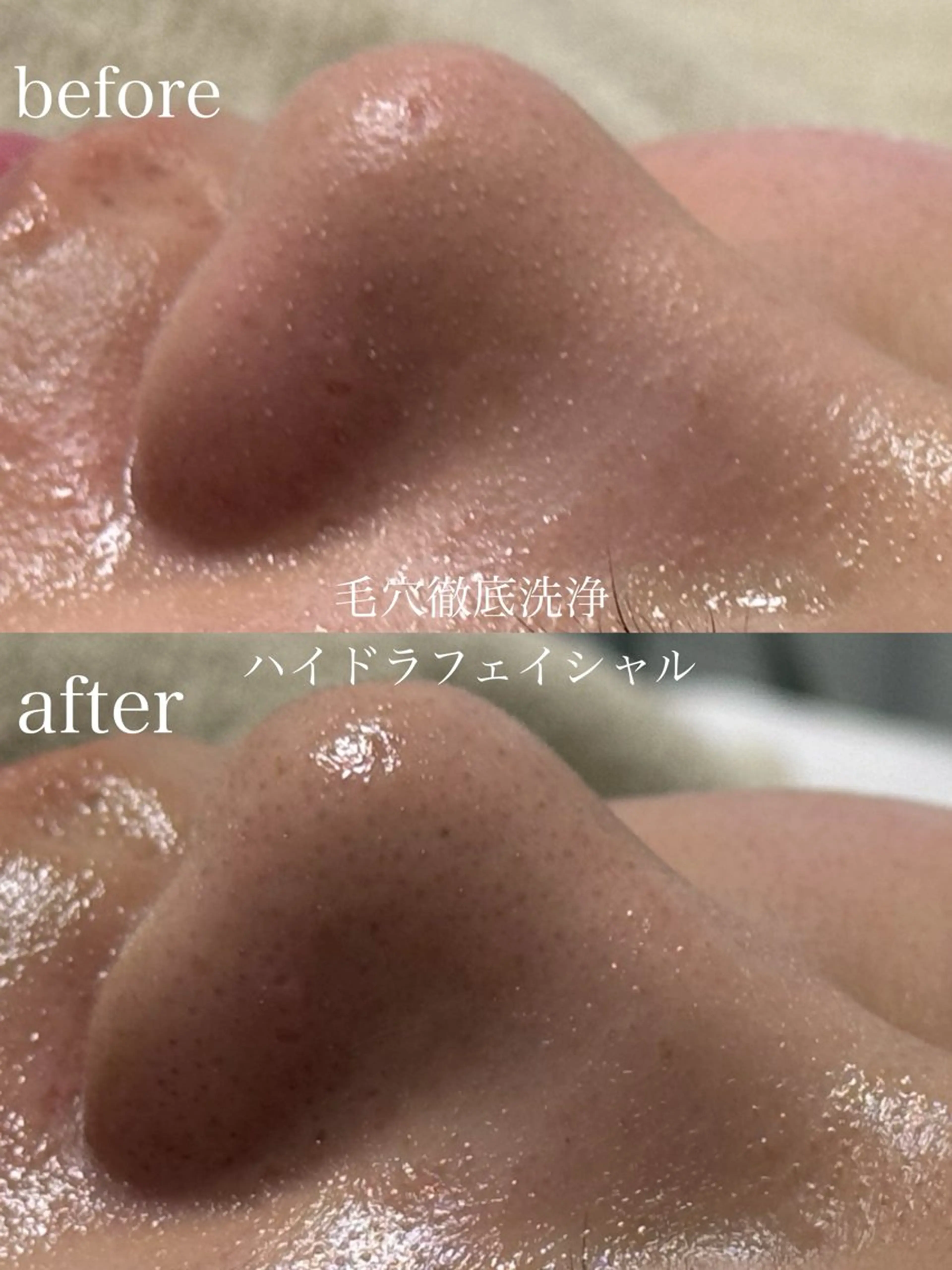 エステ フェイシャルサロン CHIARA鈴木のエステ・リラクイメージ