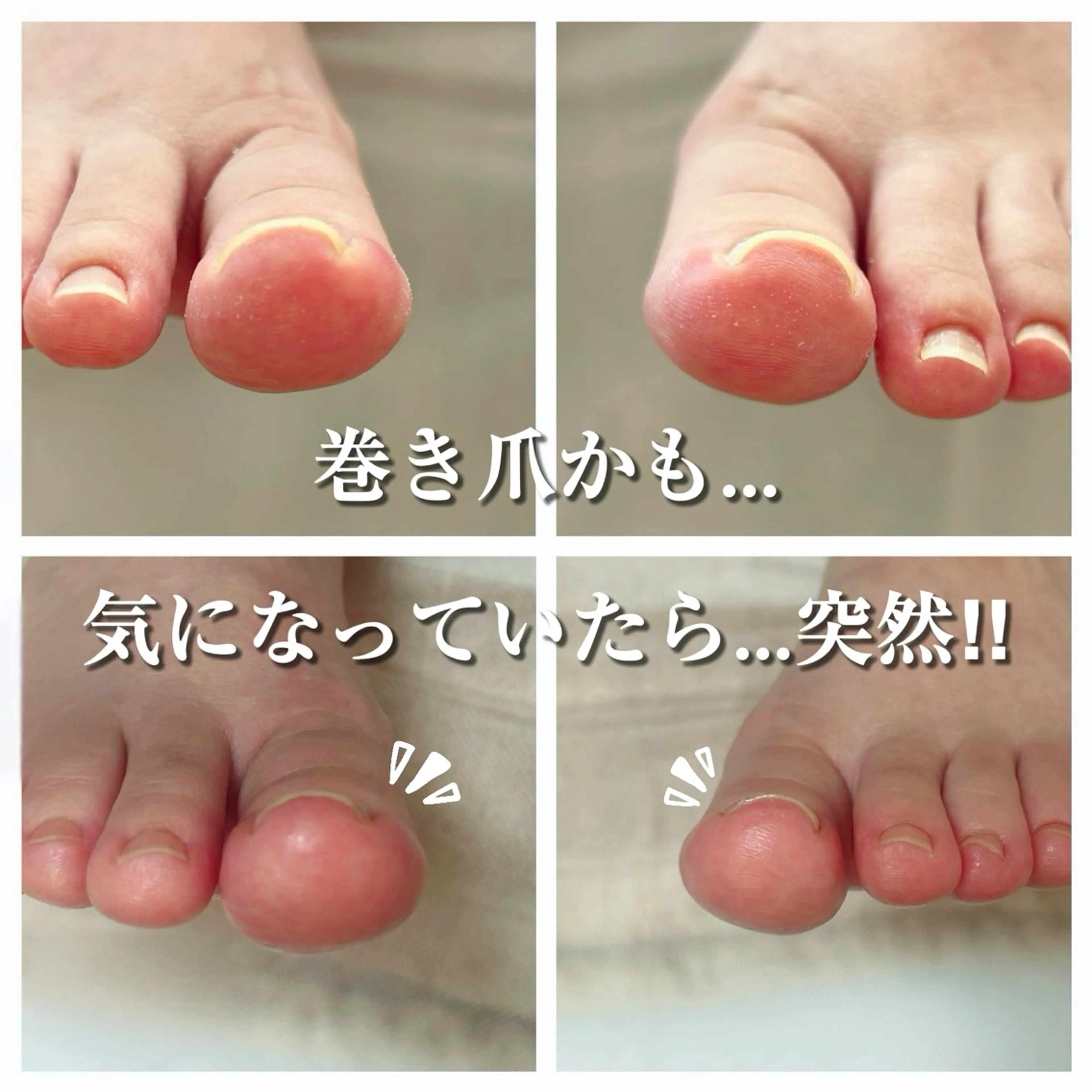 その他 巻き爪フットケアサロンKotori所属・フットケアサロン Kotoriのその他イメージ