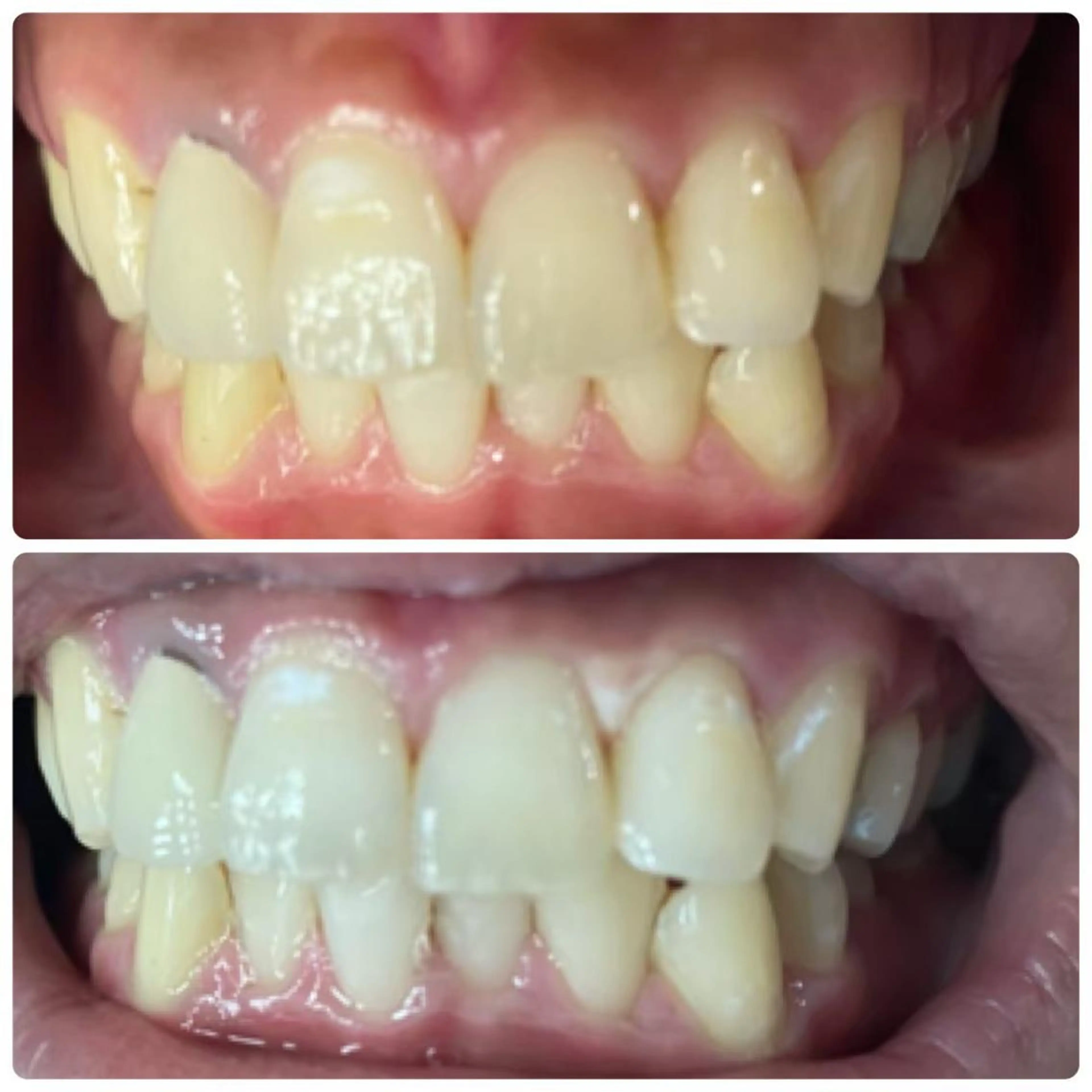 メンズ LOVEホワイト ニング恵比寿店のその他イメージ