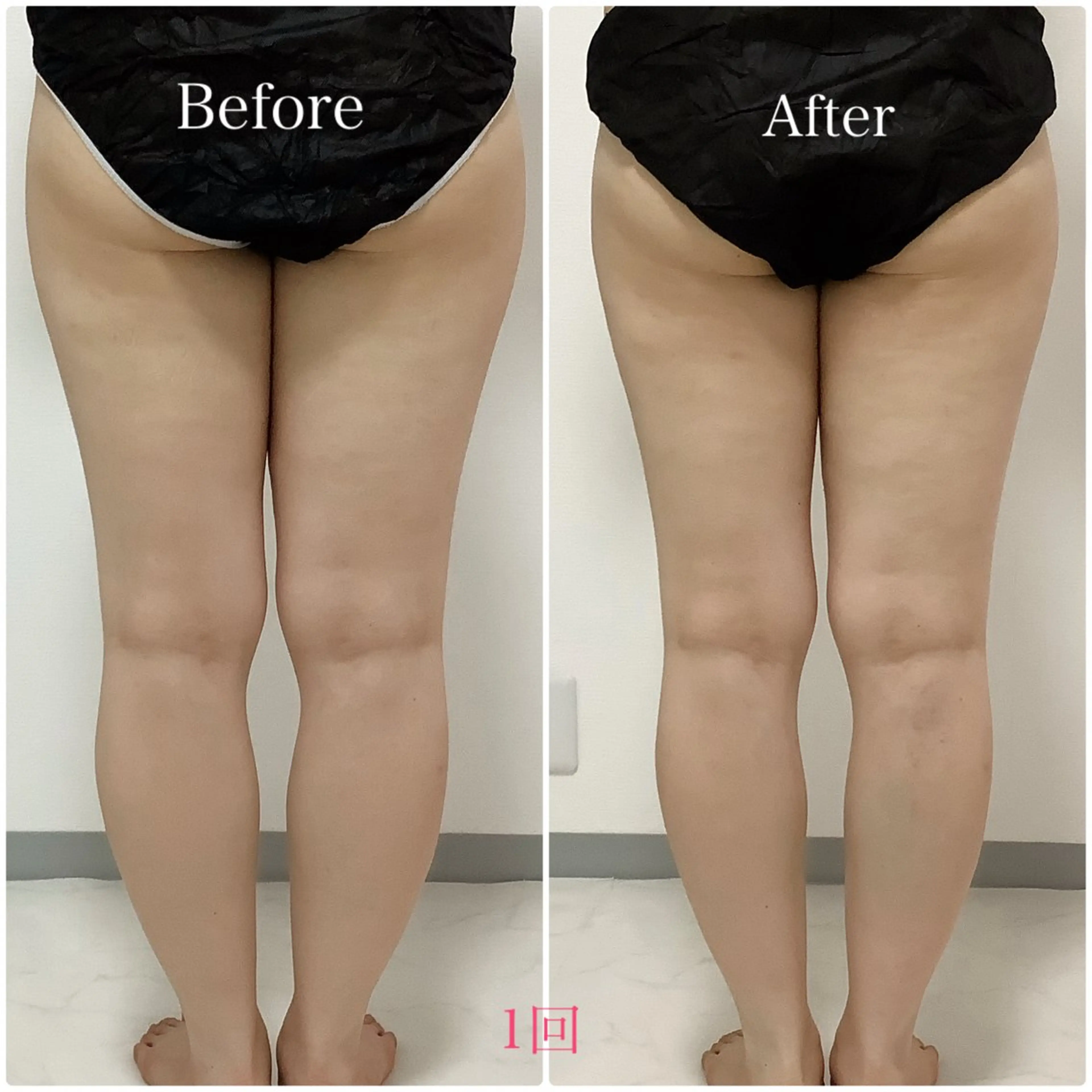 LiAm《美肌管理/ 小顔/脂肪ケア》のその他イメージ