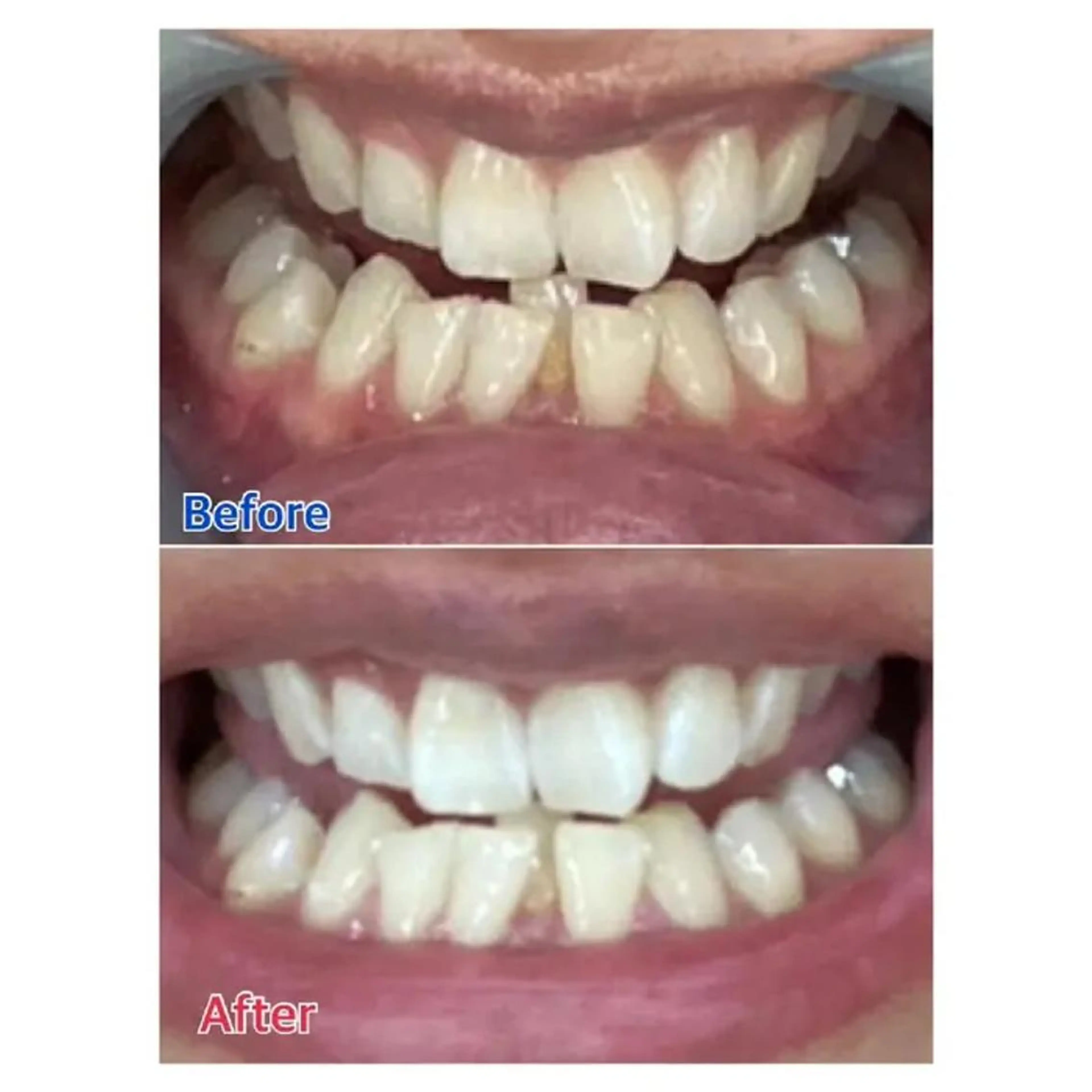 M渋谷 ホワイトニングのその他イメージ