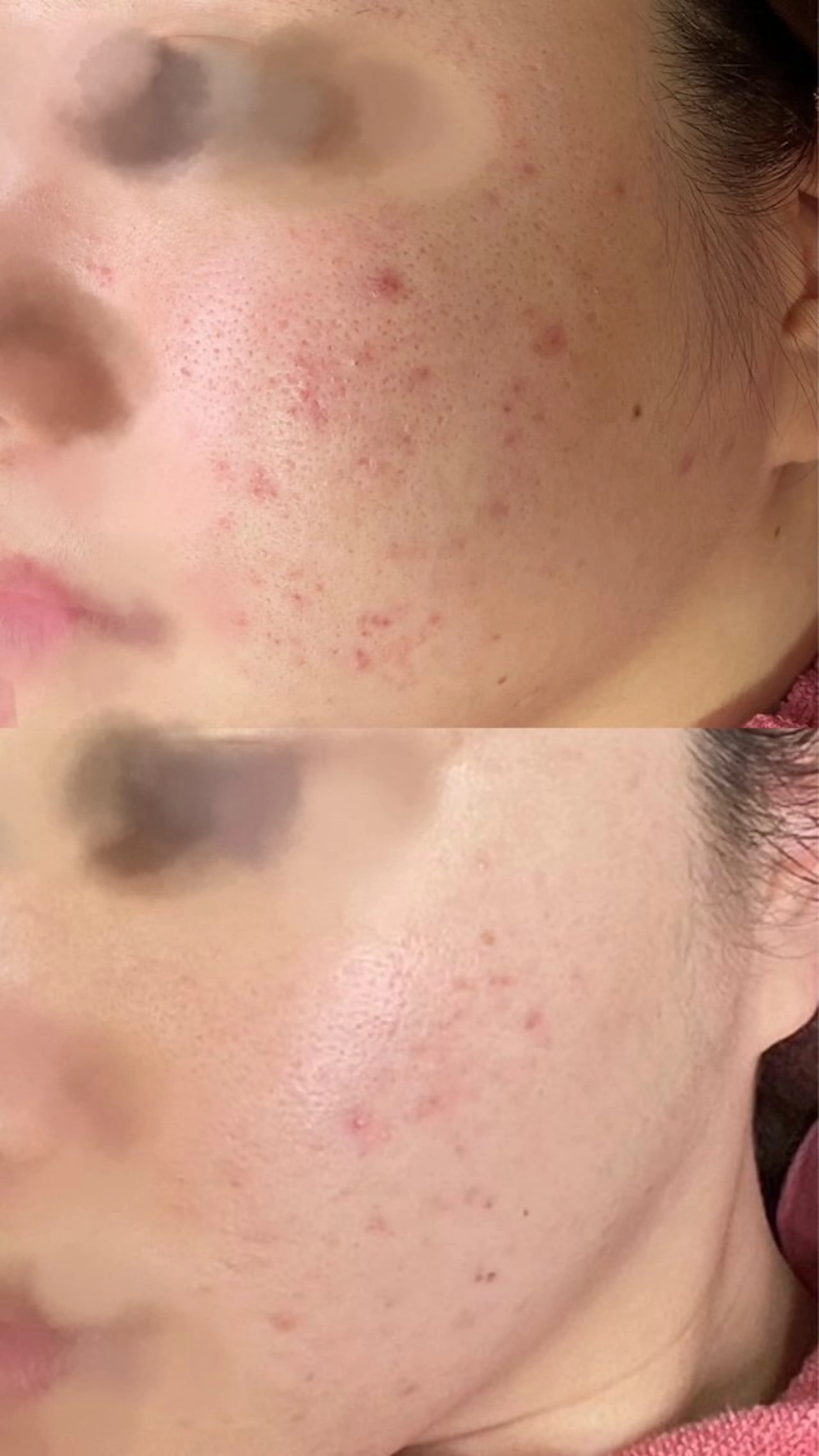 フェイシャルエステ　スペシャルコースの写真