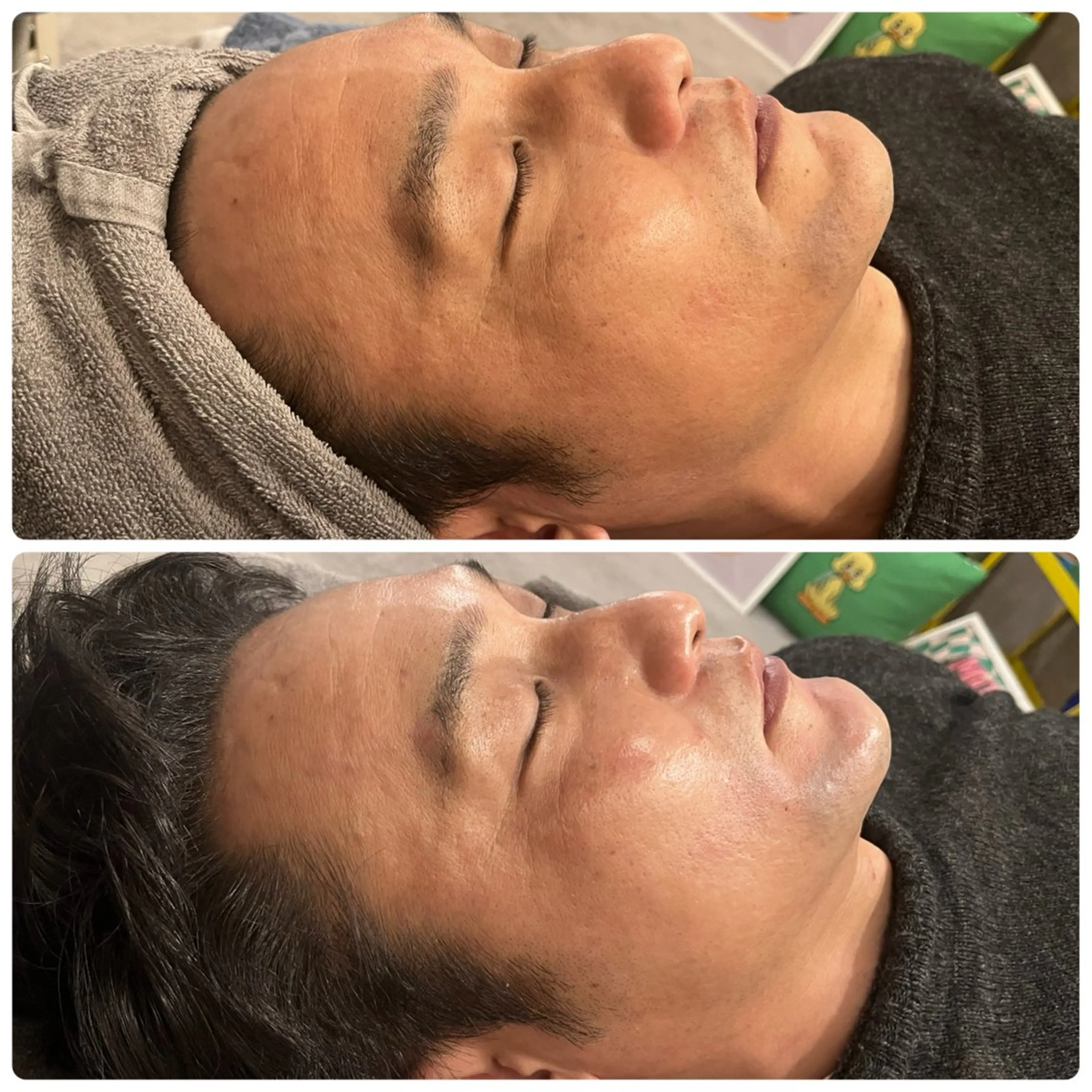 その他 yellow.所属・yellow💛【 脱毛&フェイシャル】のエステ・リラクイメージ