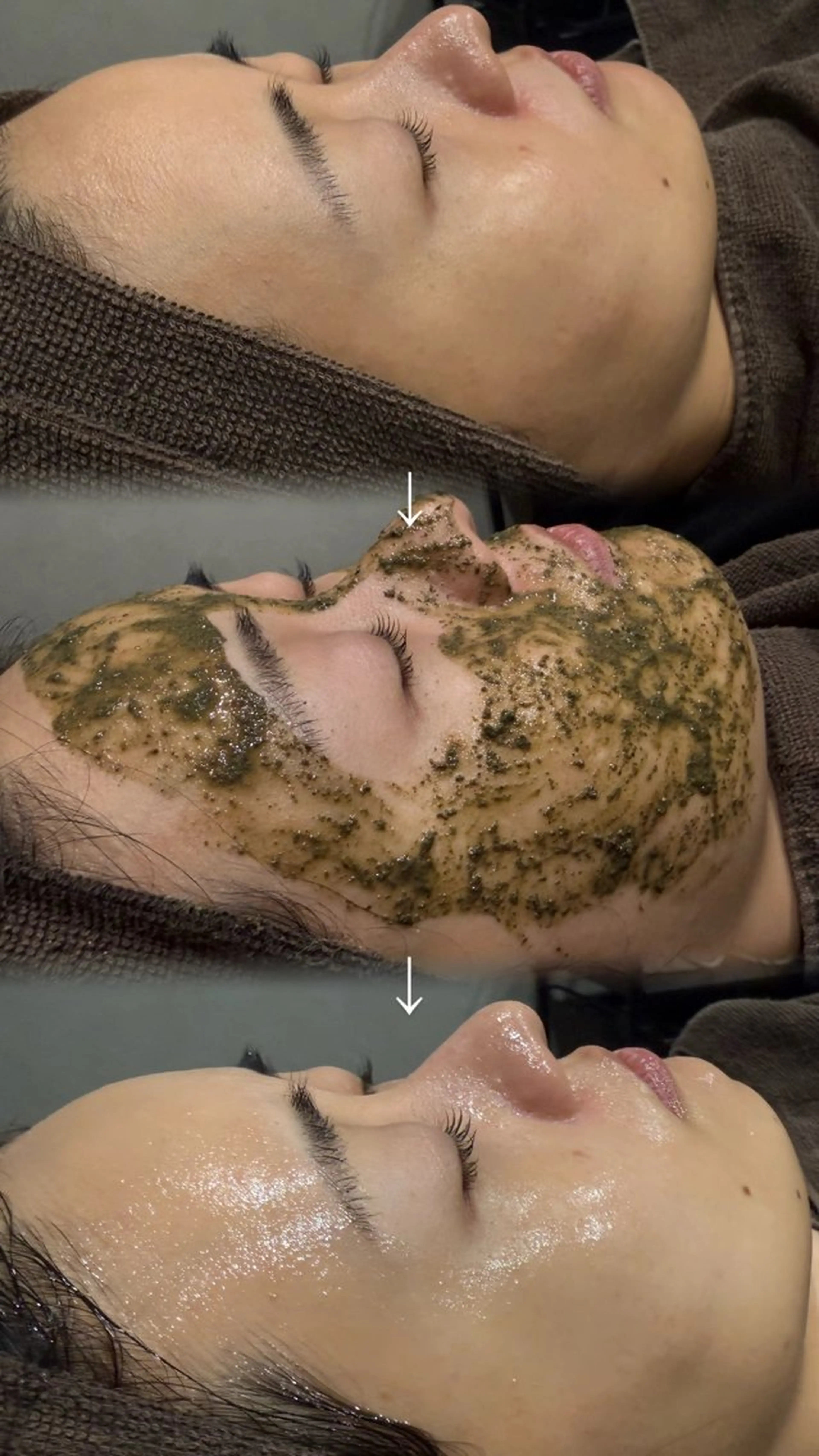 エステ 美容ナース施術 毛穴ニキビ専門サロンのエステ・リラクイメージ