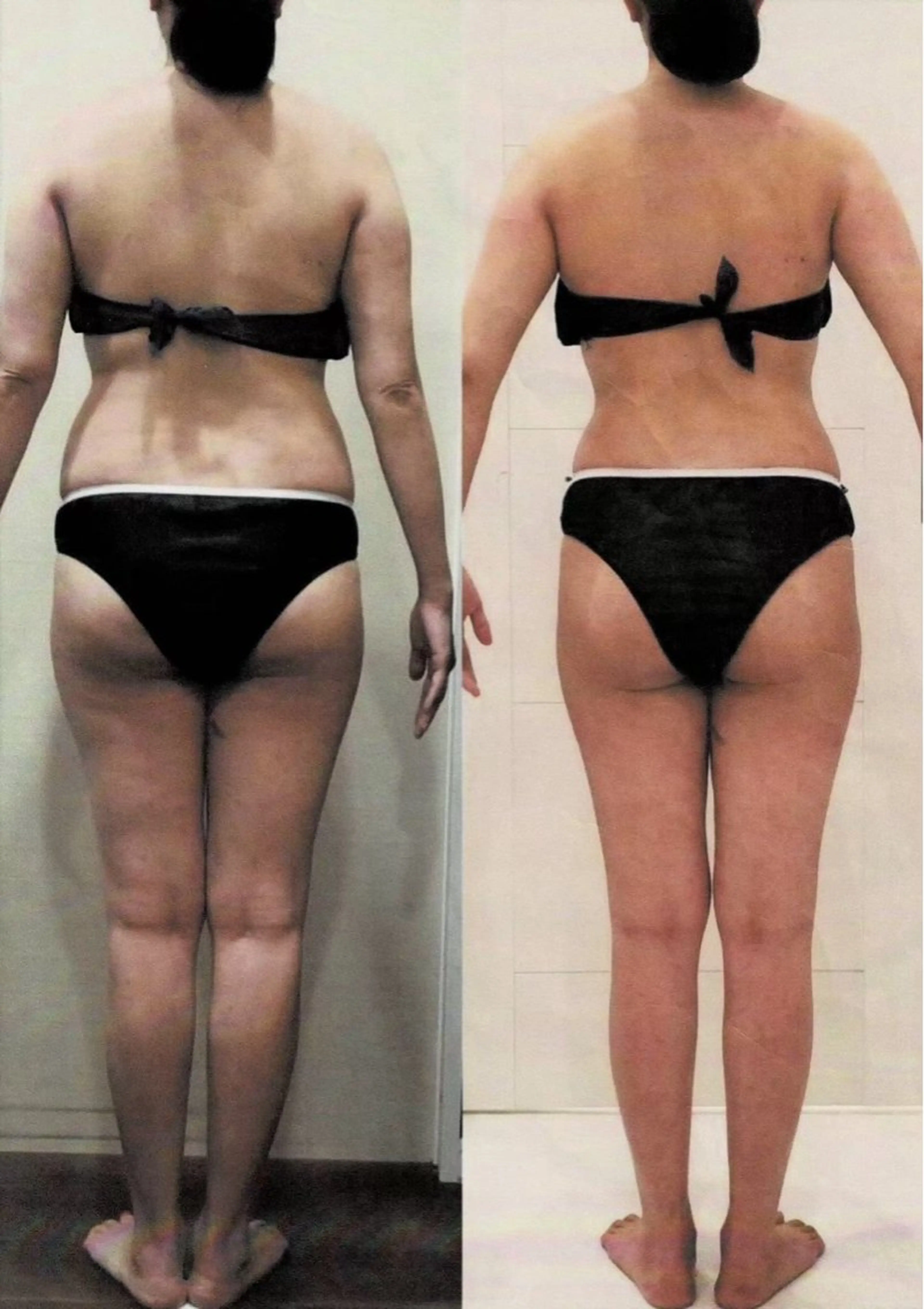 痩せたい方　モニターさん募集！ラジオ波✖️痩身エステ体験🩷一緒に痩せない原因を探しましょう！の写真