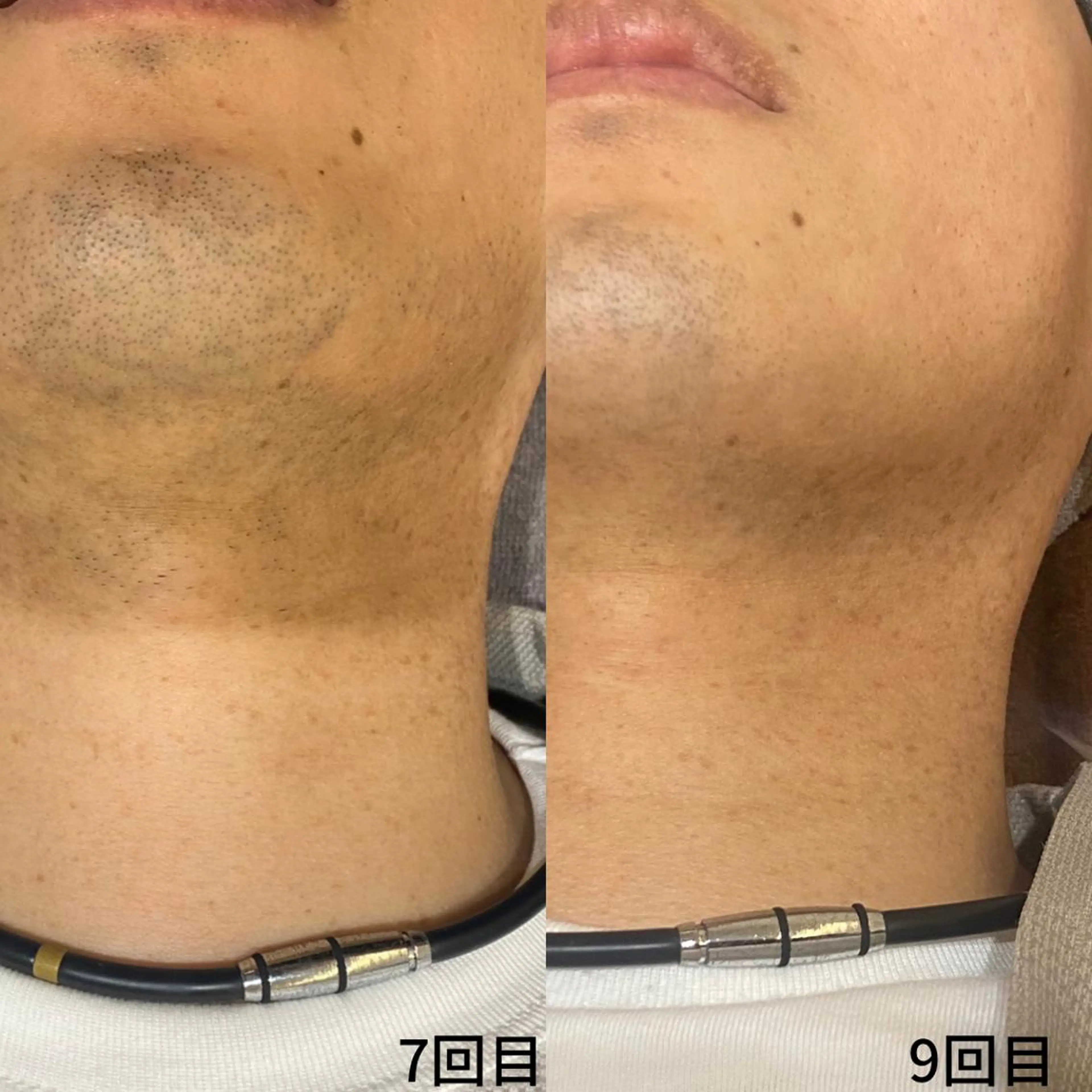 脱毛 DUPE&MORE 店長kanaeのエステ・リラクイメージ