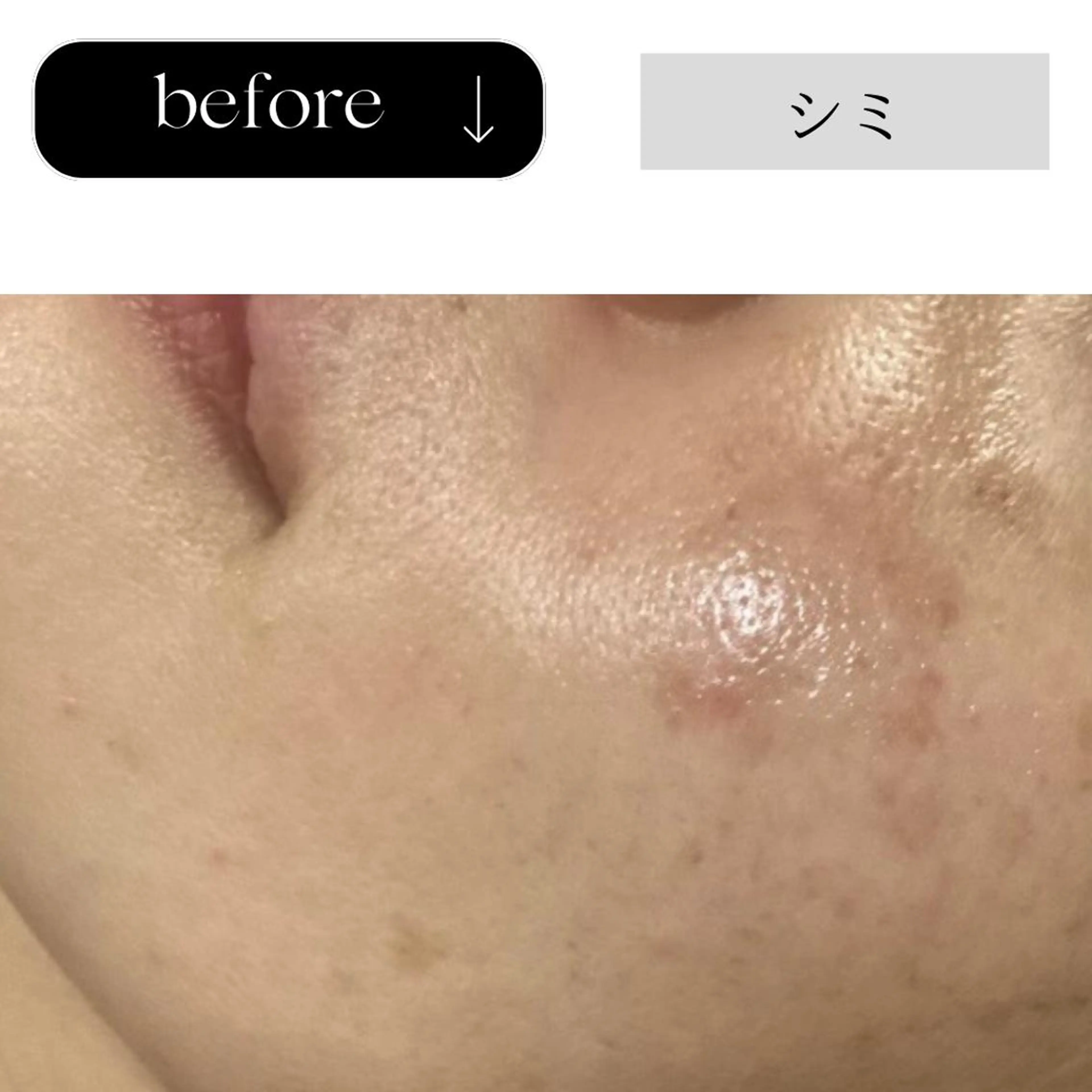 エステ beauty CHOOSEのエステ・リラクイメージ