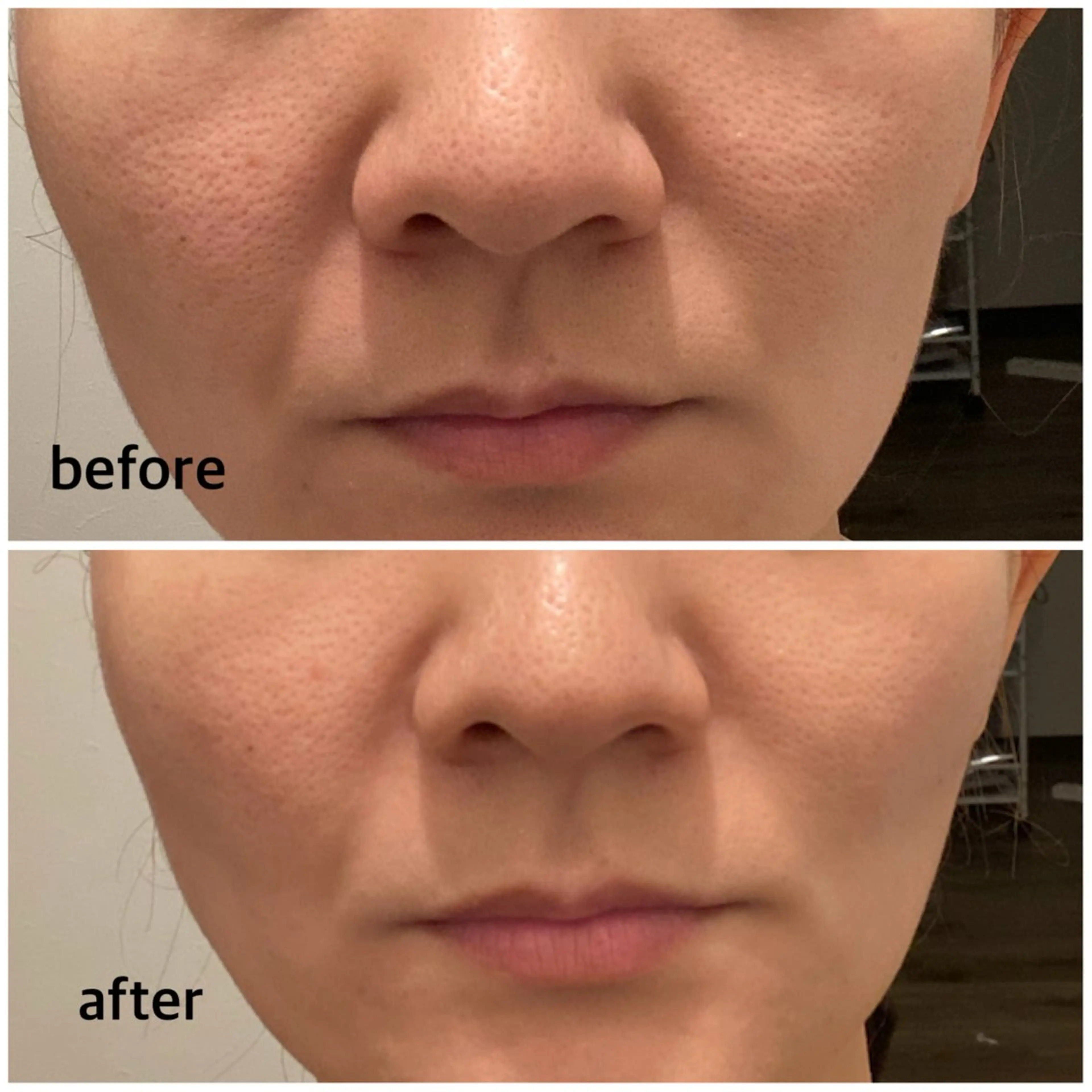 エステ 美u•p 鶴ヶ峰店のマツエク・マツパデザイン