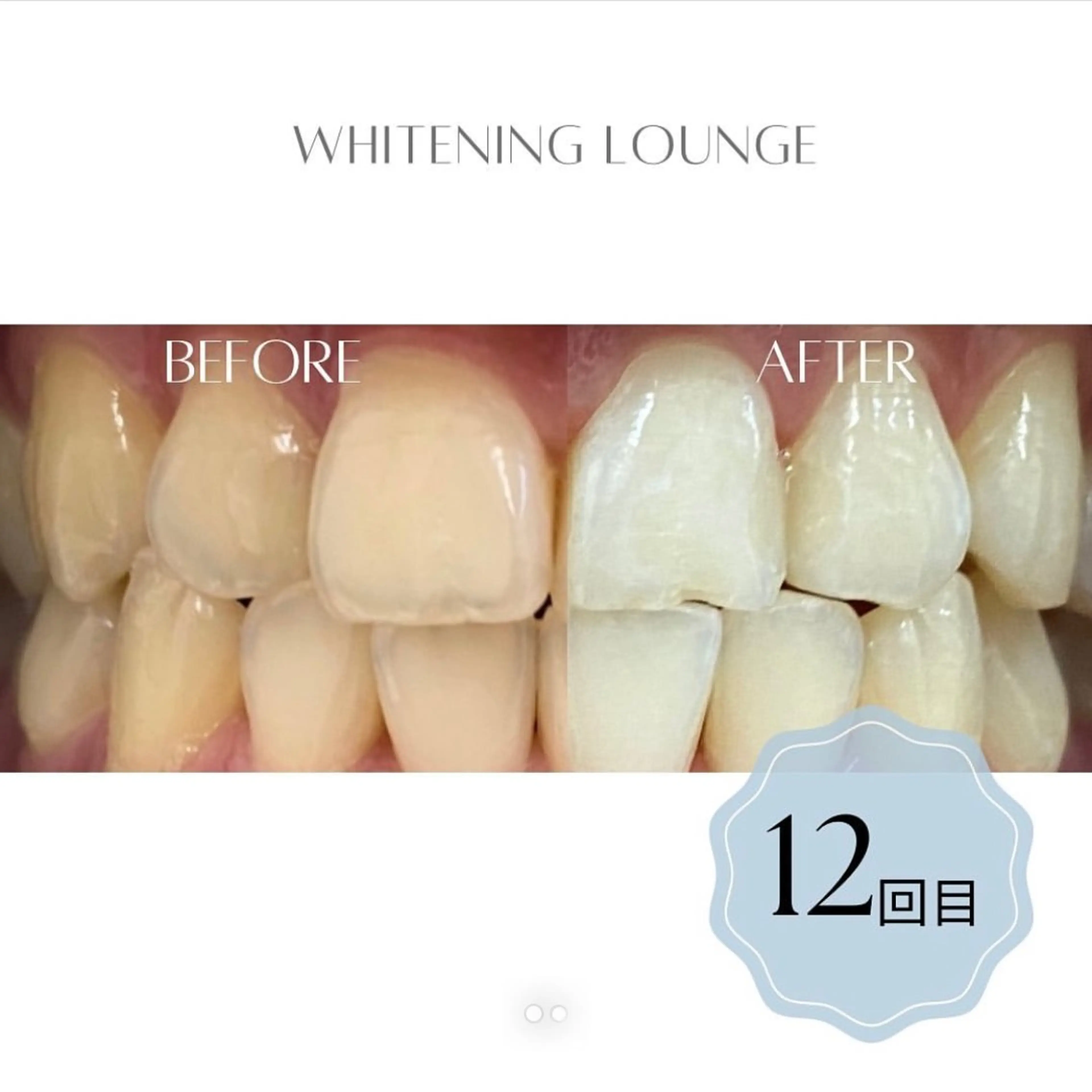 ホワイトニングラウンジ横須賀所属・ホワイトニング Lounge横須賀のエステ・リラクイメージ