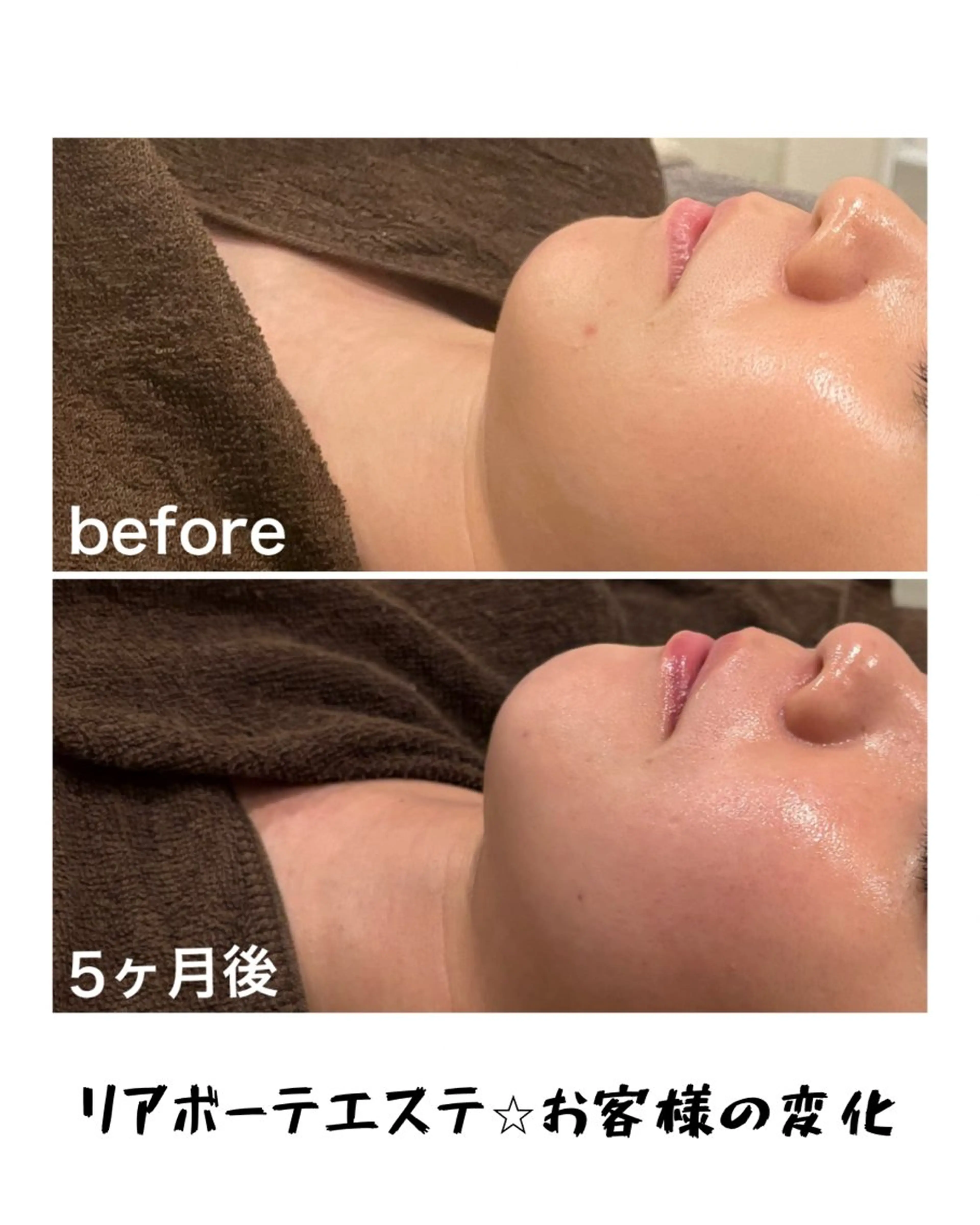 エステ 浜野 恵美のエステ・リラクイメージ