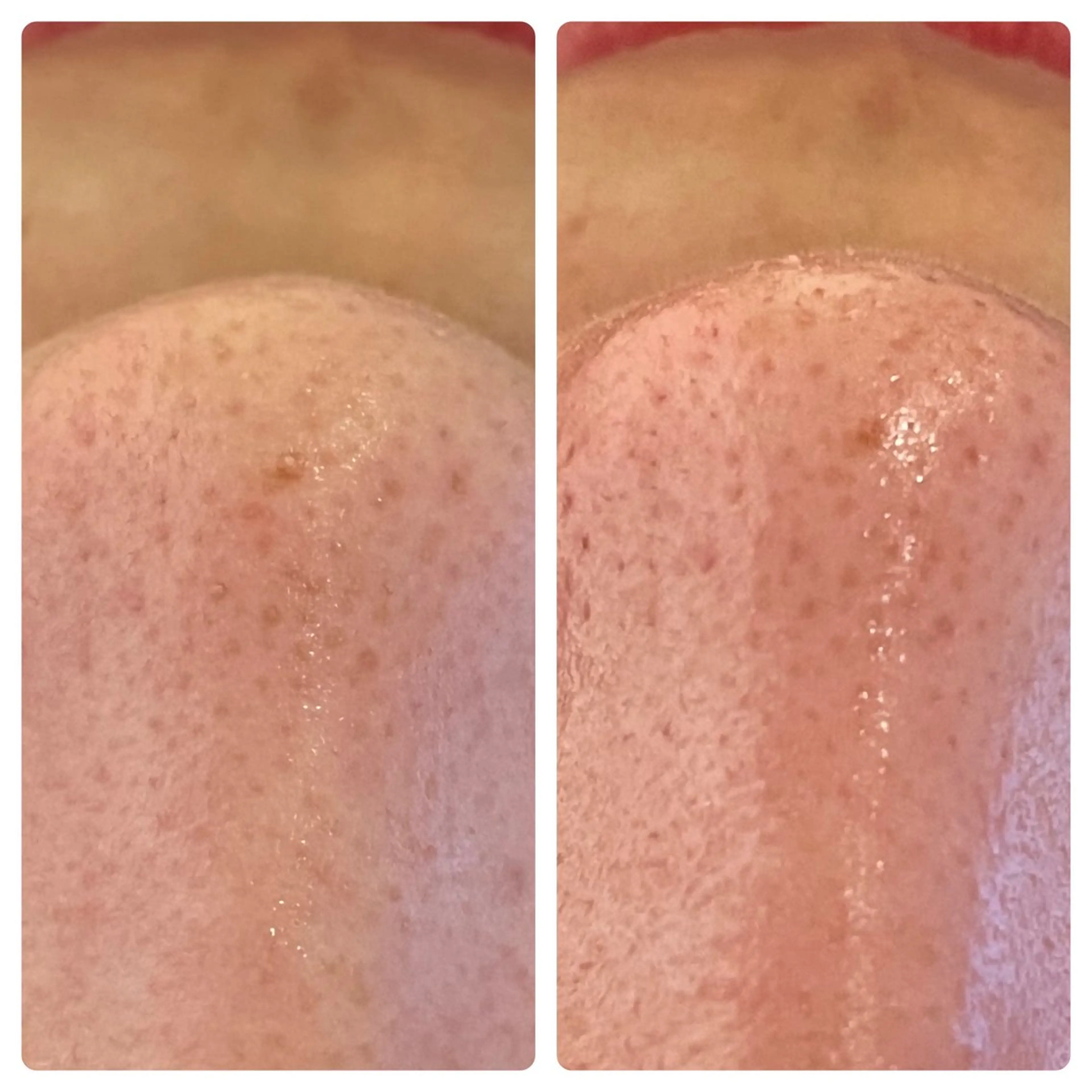 Blue Moon 【ブルームーン】のエステ・リラクイメージ