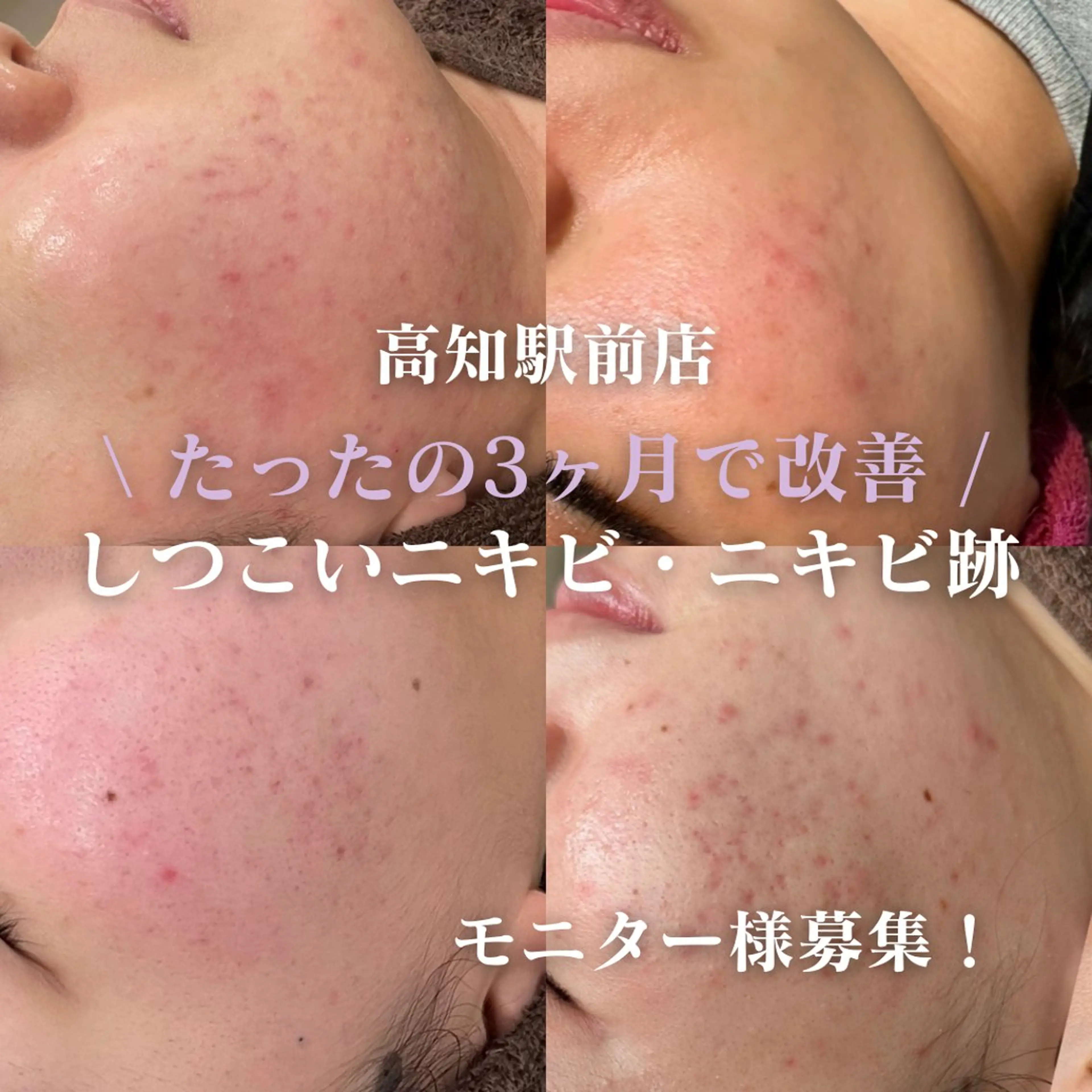 HIMEKA 肌質改善専門のエステ・リラクイメージ