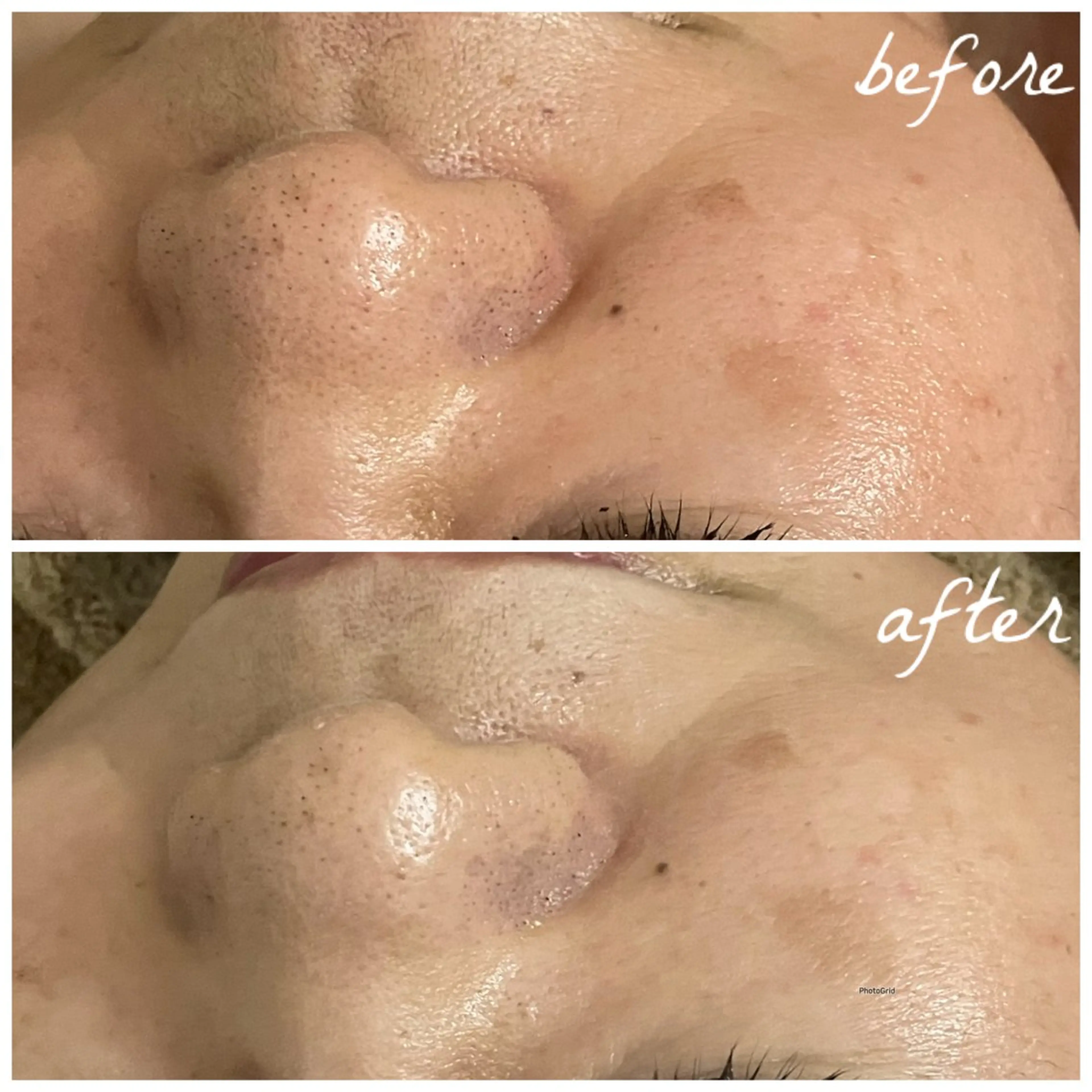 メンズ エステ メナード岐阜市茜部 杉浦のエステ・リラクイメージ