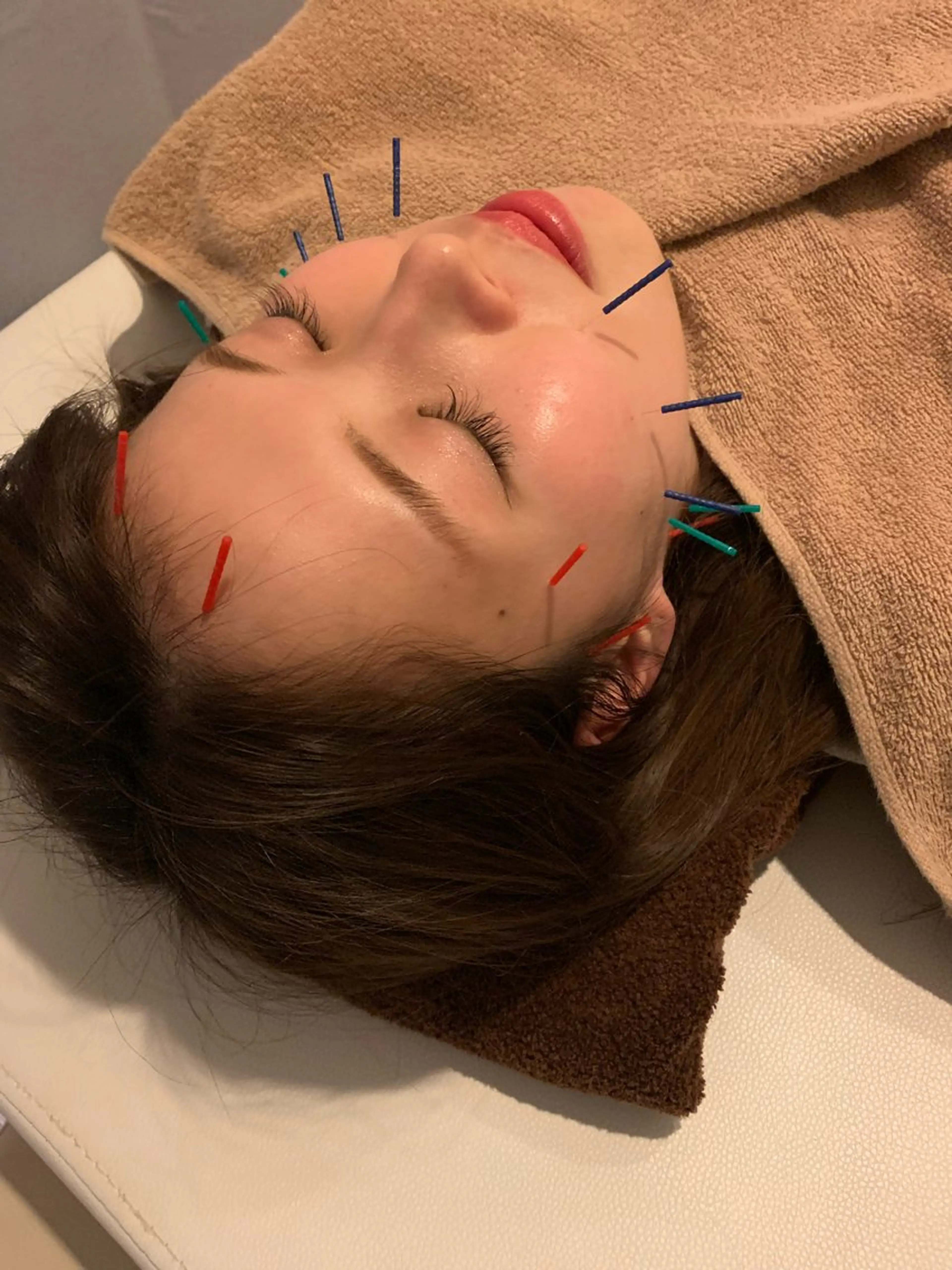 その他 小林整骨院本町 美容鍼roomのエステ・リラクイメージ