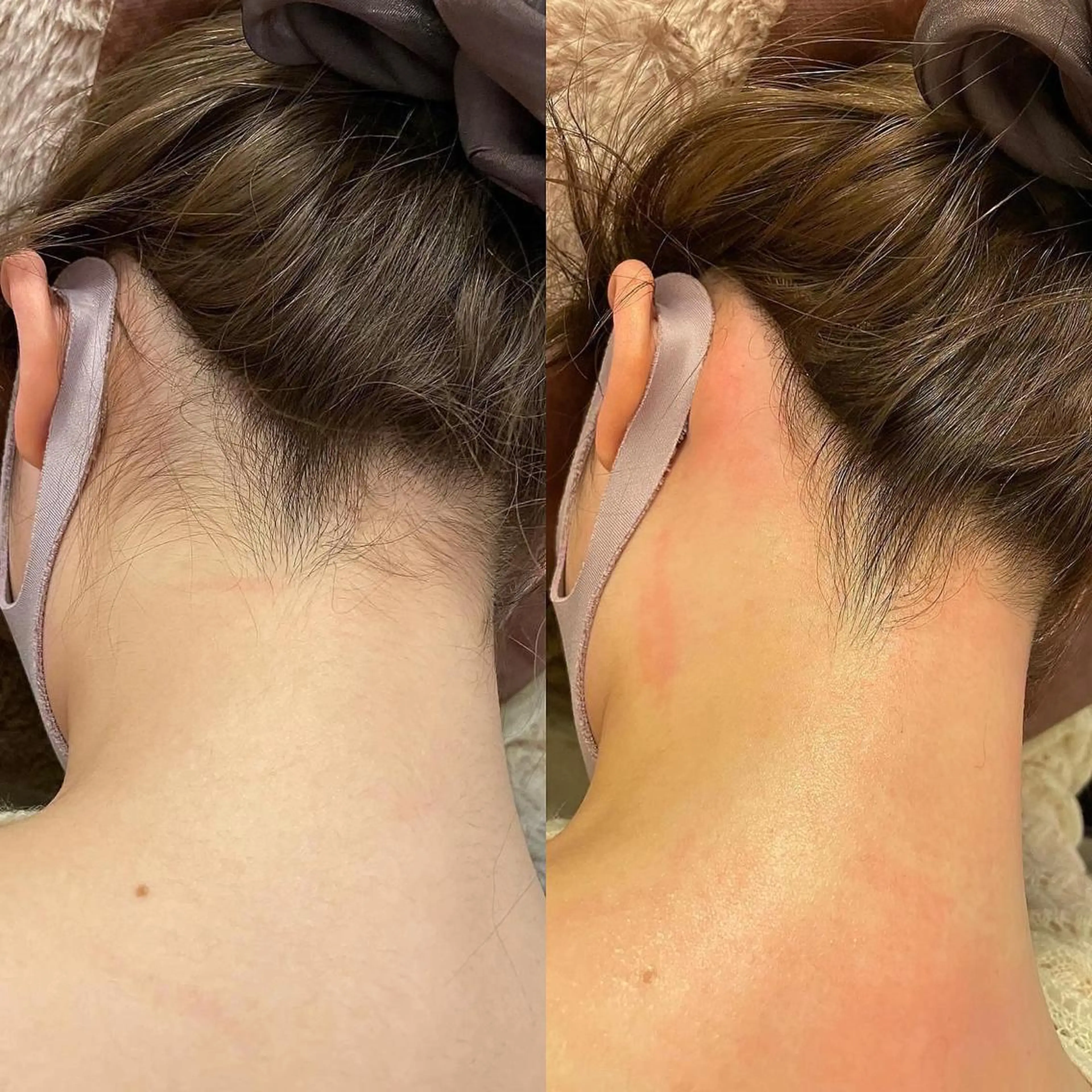 ショート ネイル マツエク・マツパ アイブロウ 眉毛ワックス脱毛 脱毛 女性のお悩み美容 サロン ヴィーナスのエステ・リラクイメージ