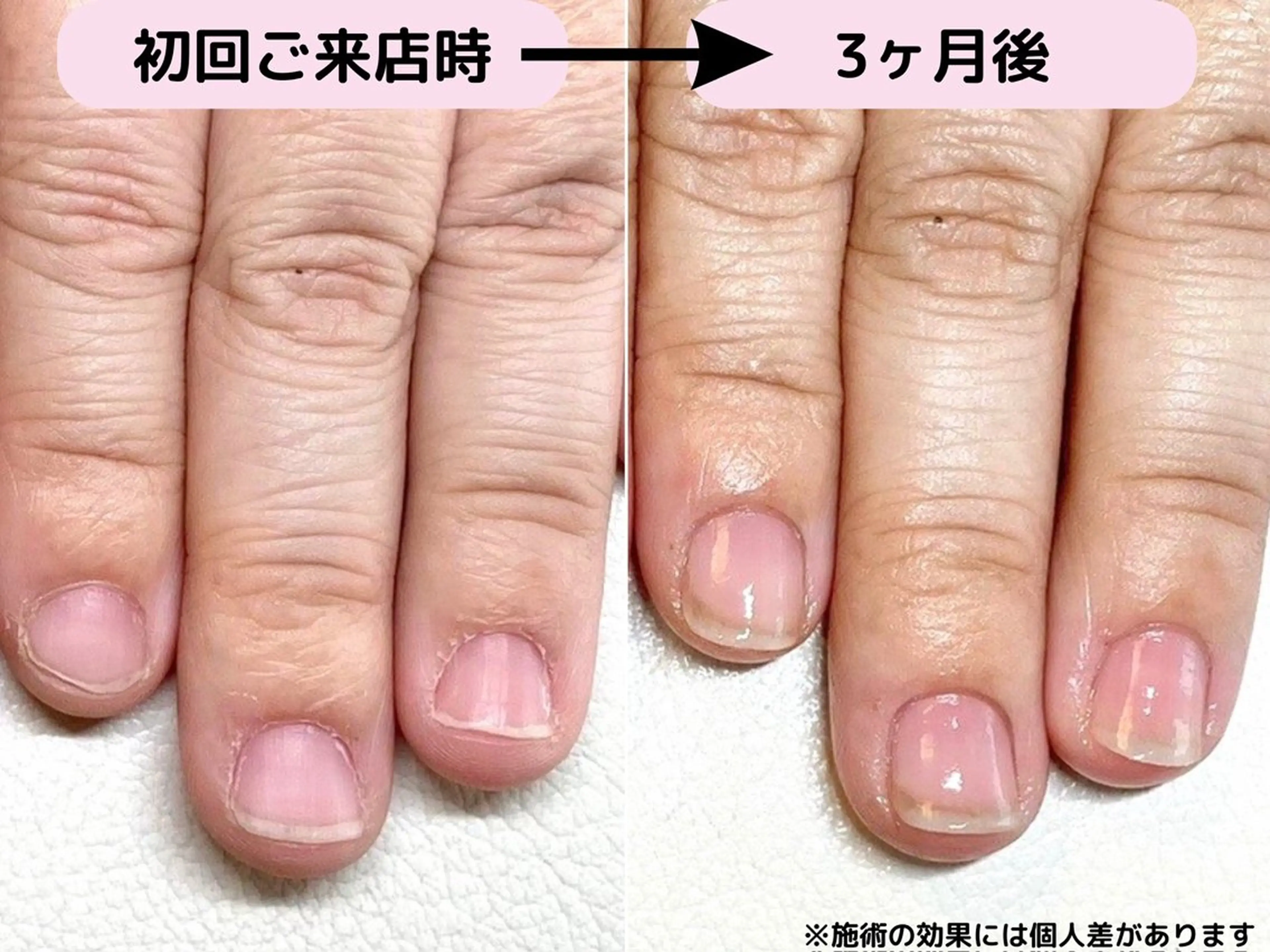 ネイル ハンドケア 自爪育成専門店Ka pilina所属・自爪育成専門店 Kapilinaのネイルデザイン