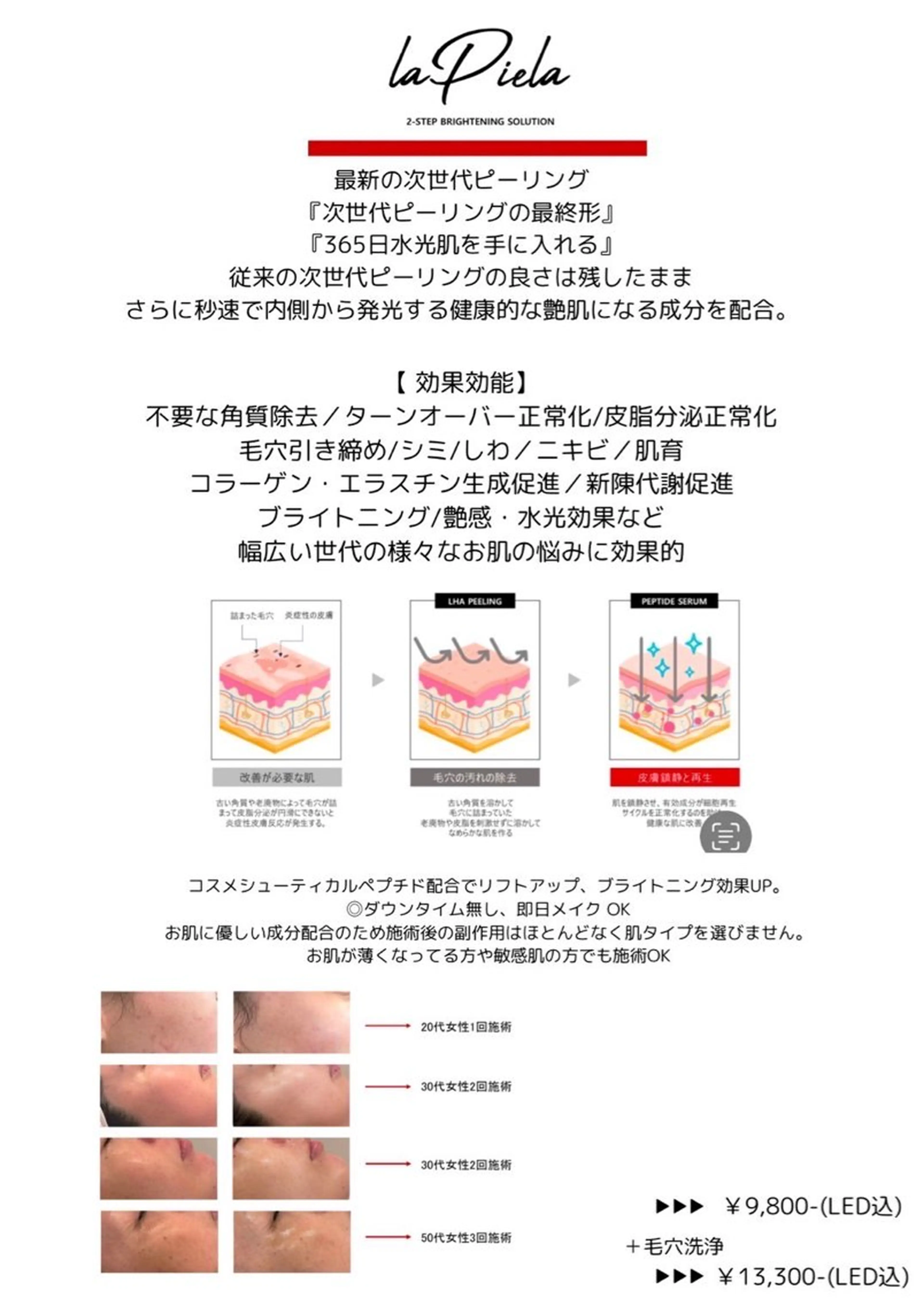 ENCHANT Kaede/肌質改善のその他イメージ