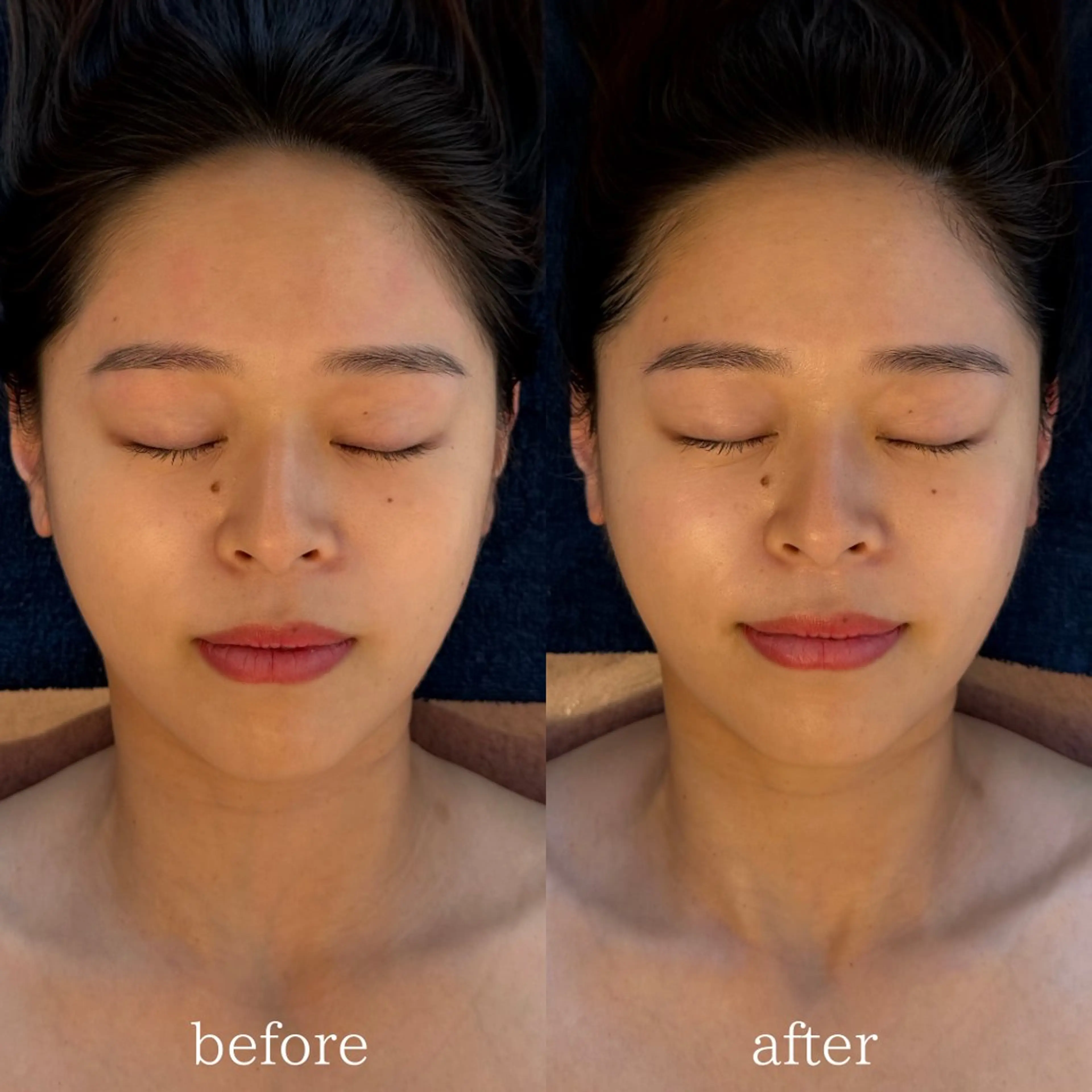 エステ 眉毛/小顔/ハーブ 🌼hikaruの眉毛・アイブロウイメージ