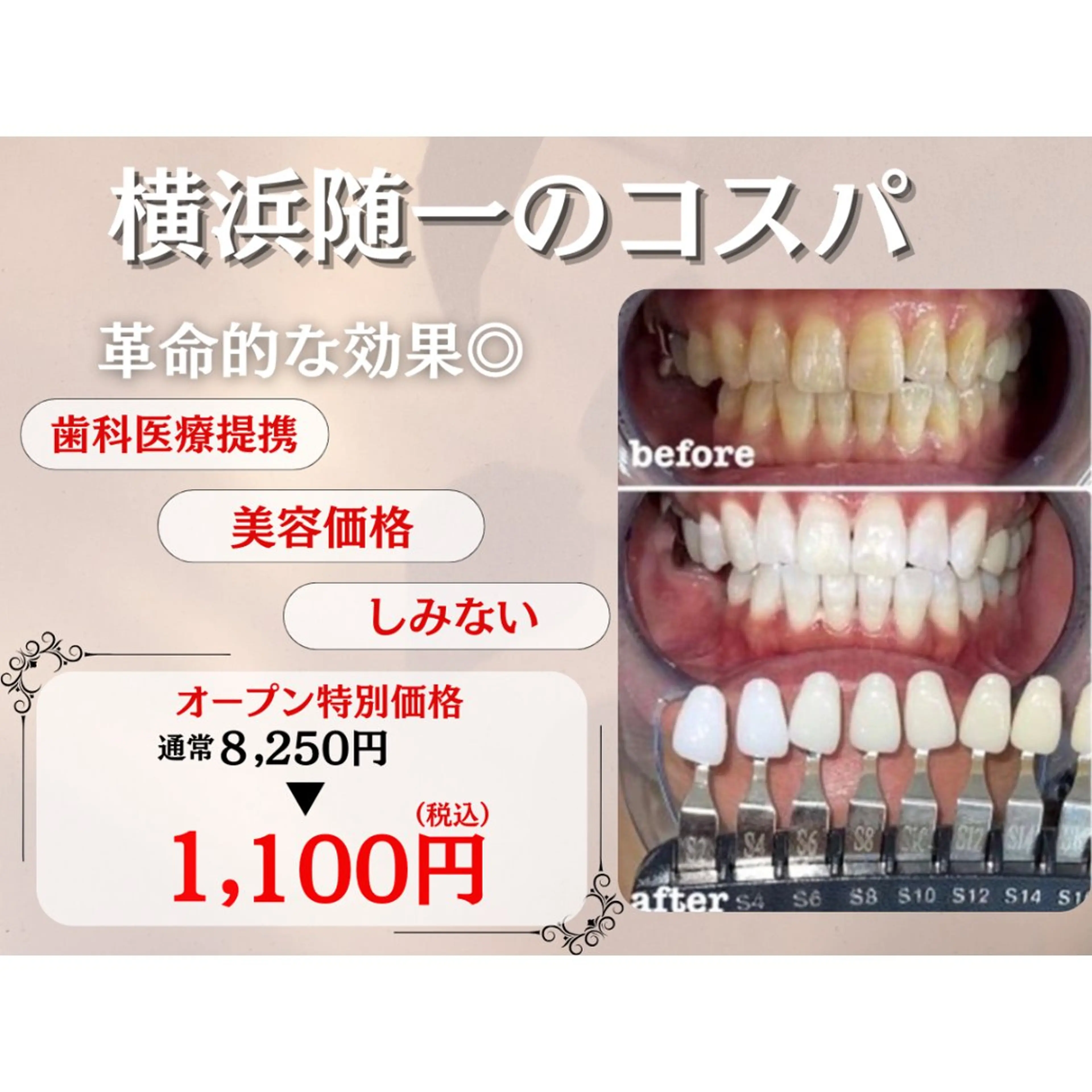 エステ PureWhitening所属・ピュアホワイトニング 横浜店のエステ・リラクイメージ