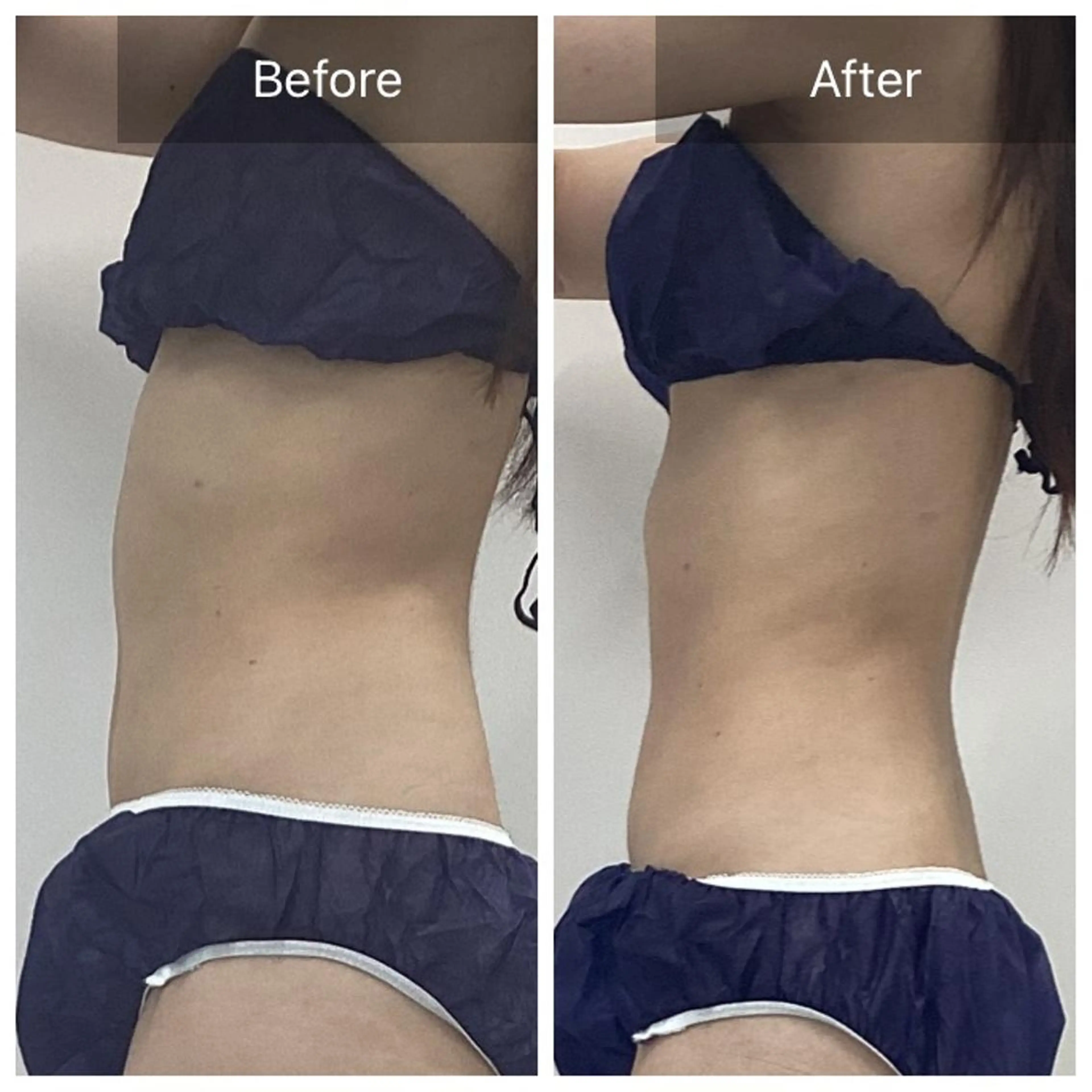 【結果重視◎本気ダイエット】痩身マシン3種＆全身オールハンドコルギ 120分¥24800→18500の写真