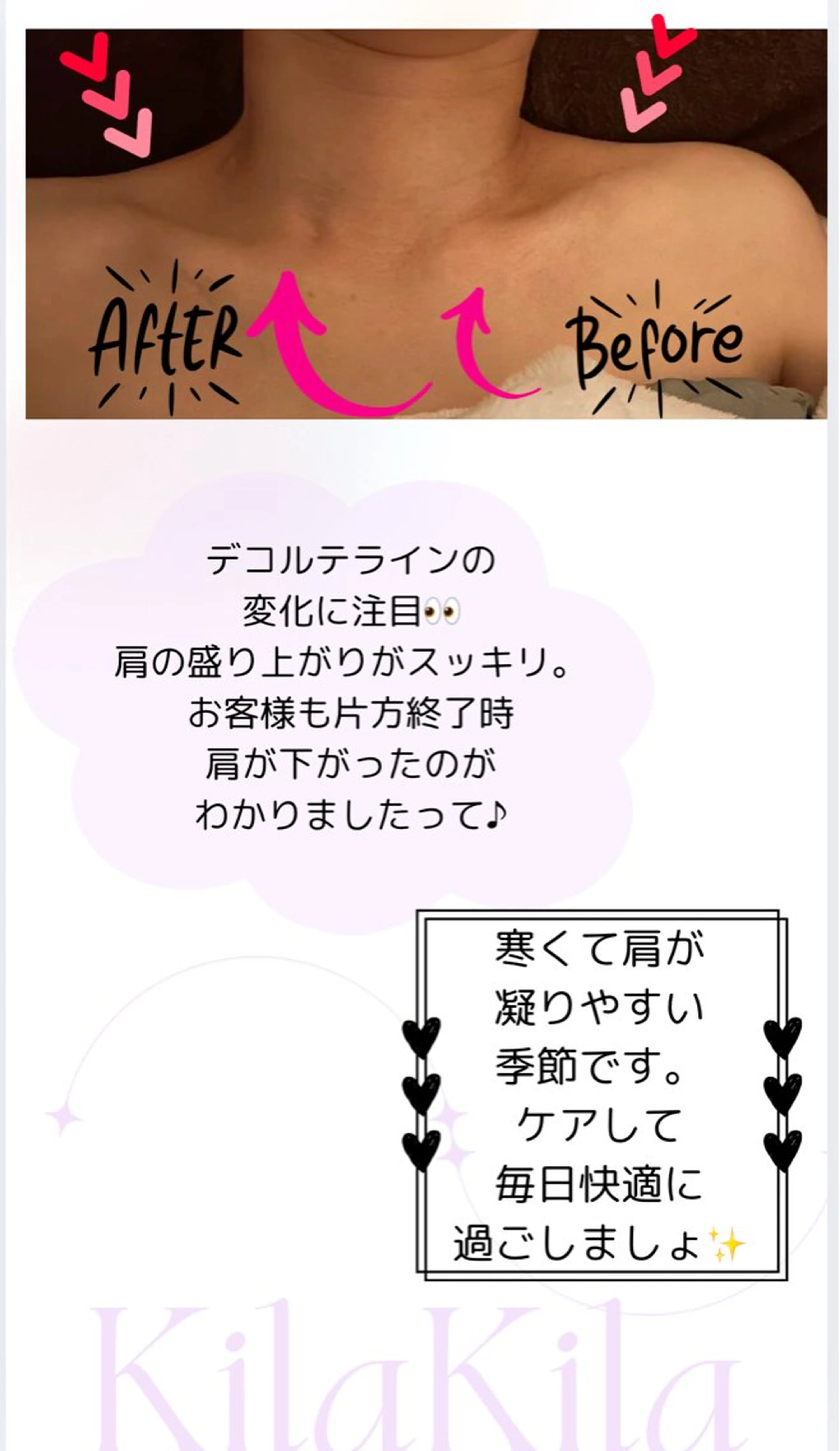 ドライヘッドスパ KilaKilaのエステ・リラクイメージ