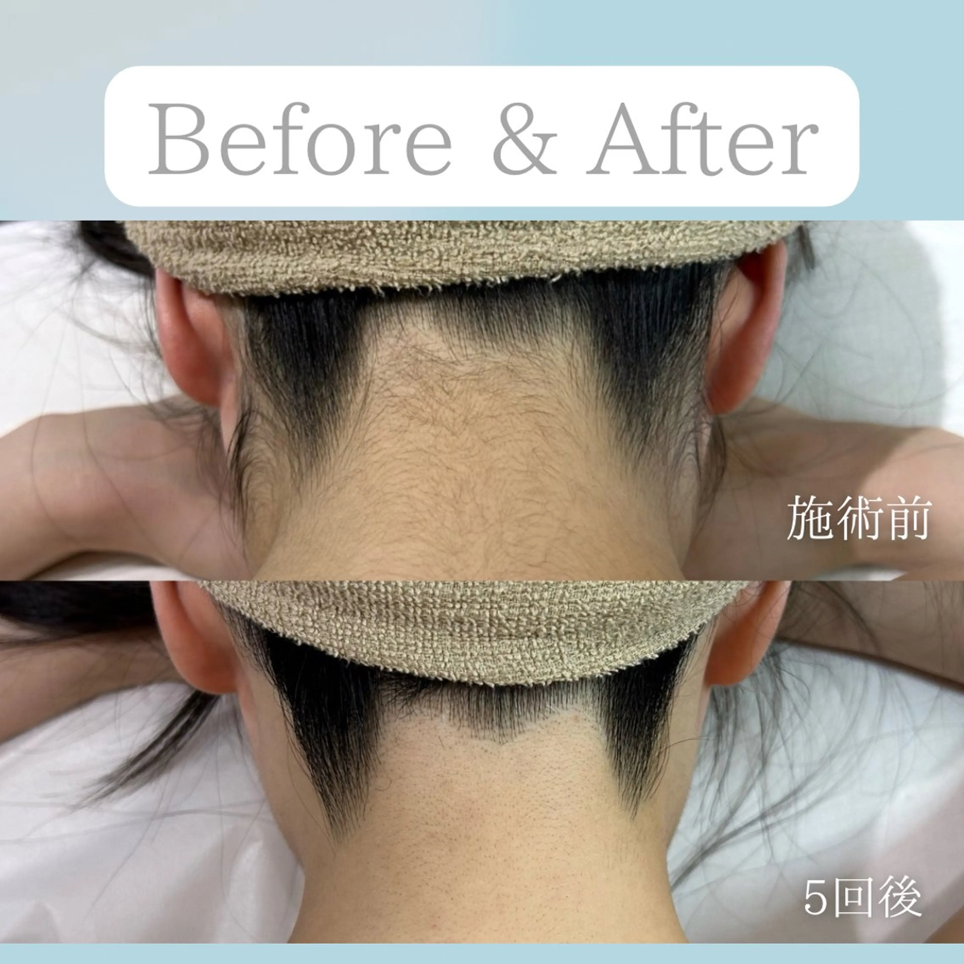 美肌脱毛&毛穴専門 Nico🐰ྀི♡のエステ・リラクイメージ